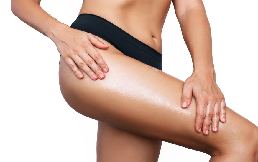 Liposuction revision by Dr. Carlos Mata in Scottsdale, AZ
