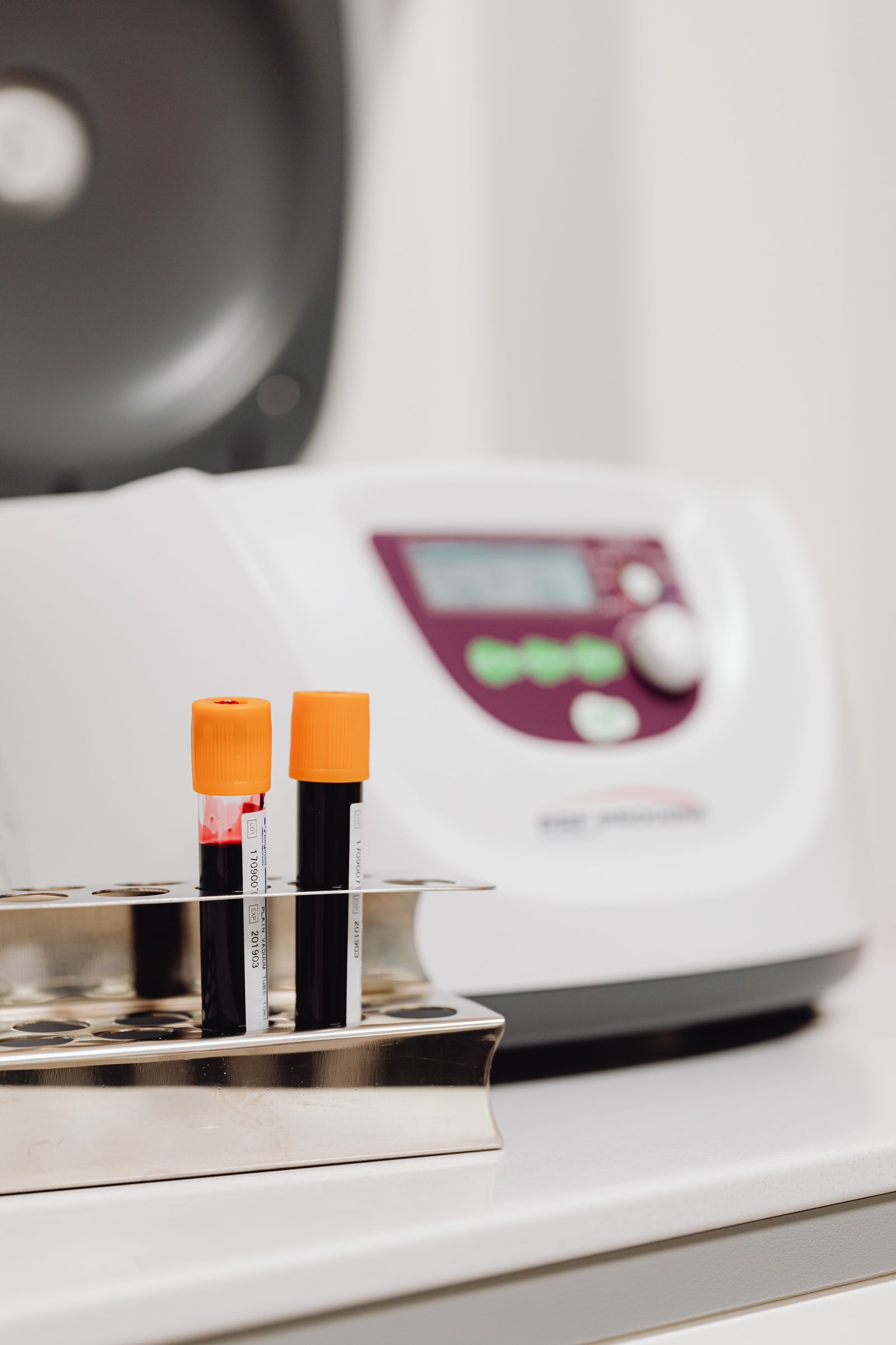 Platelet Rich Plasma at Natural Results in Scottsdale, AZ