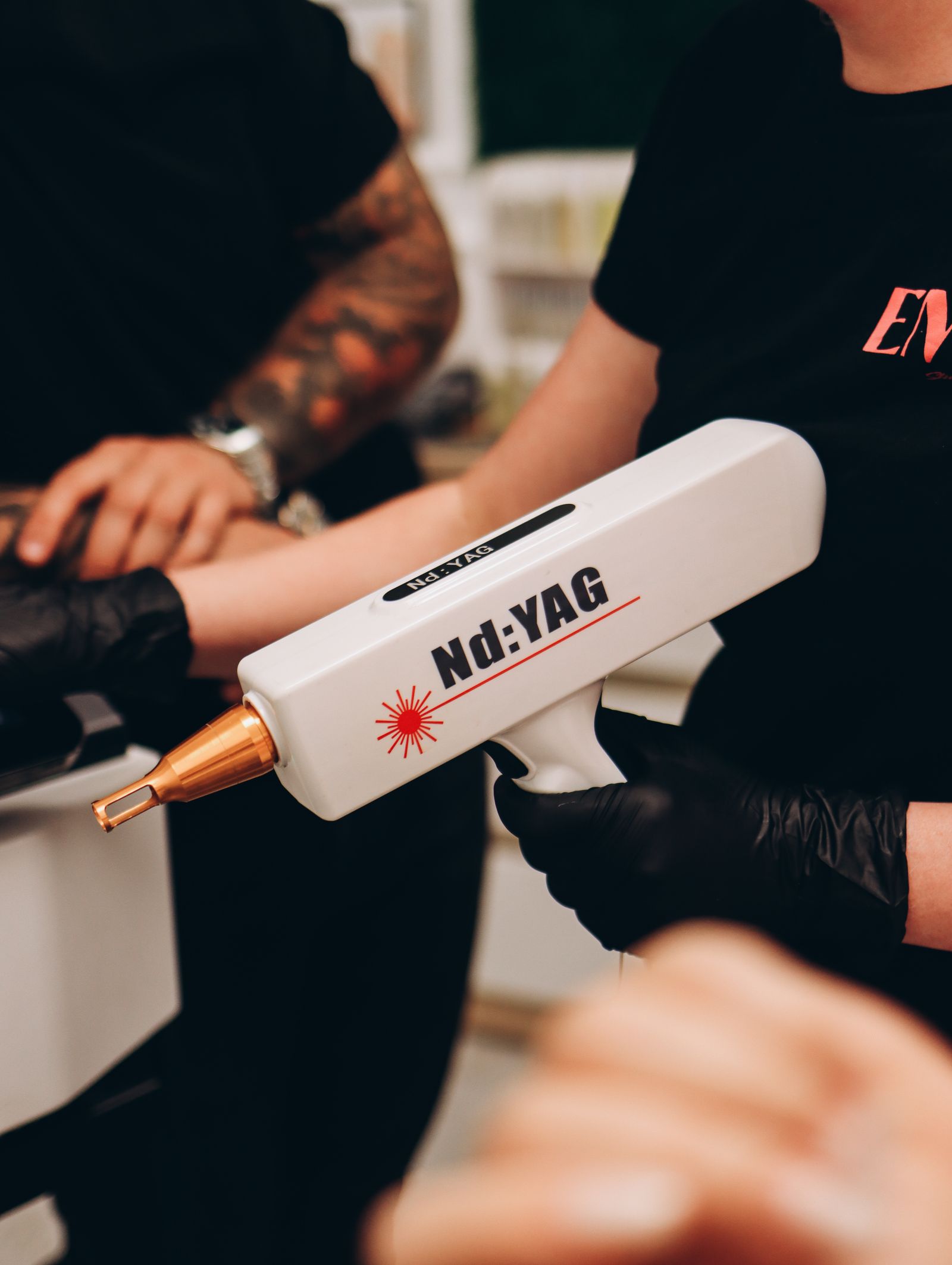 Laser tattoo removal at Natural Results