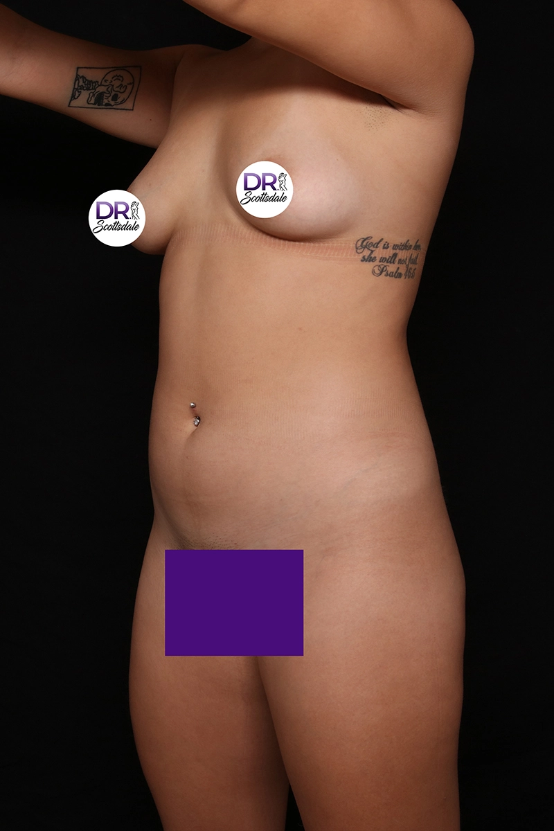 Scottsdale Skinny 92231_before_opt