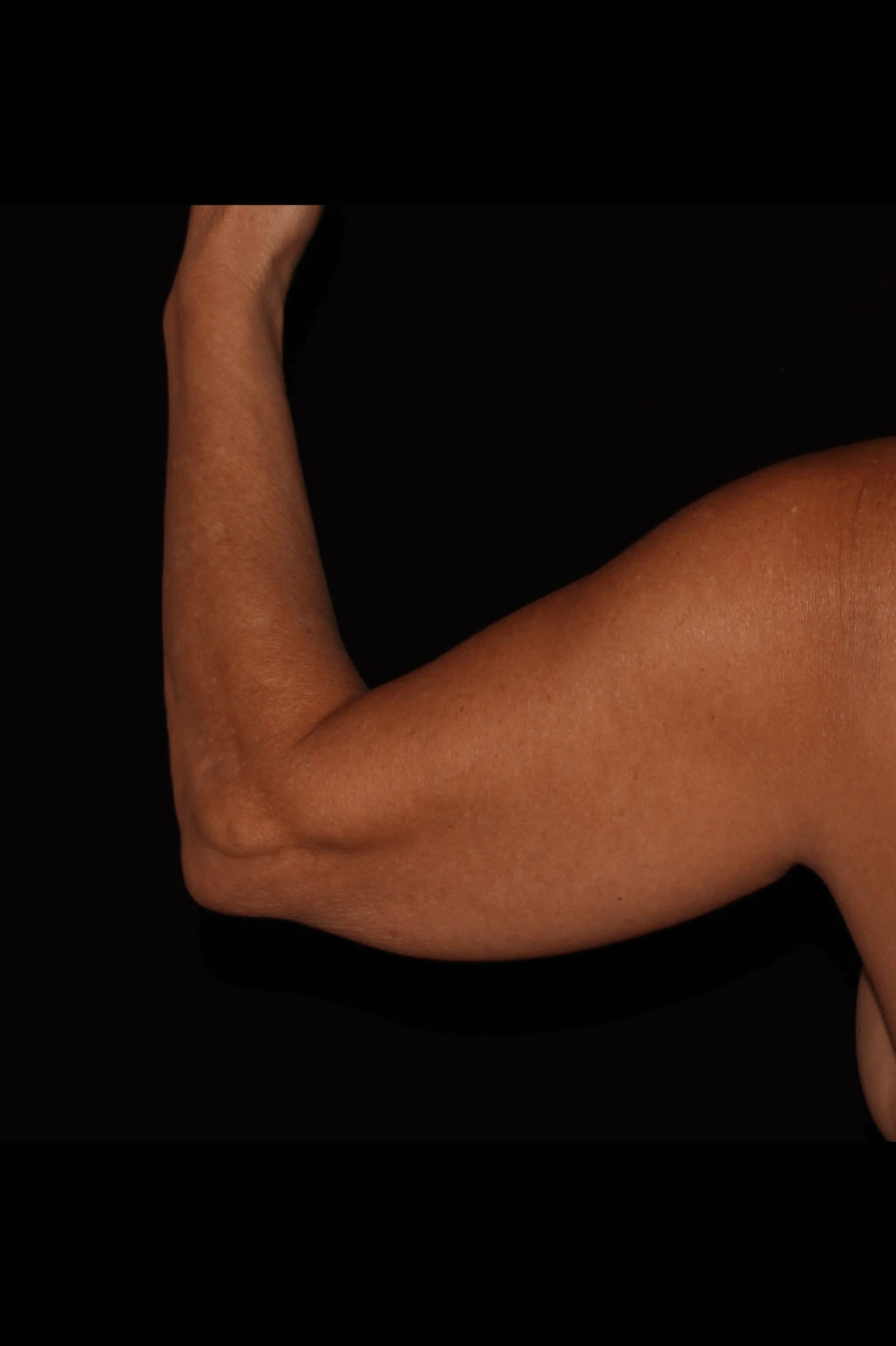 Case #0011221 Before Back