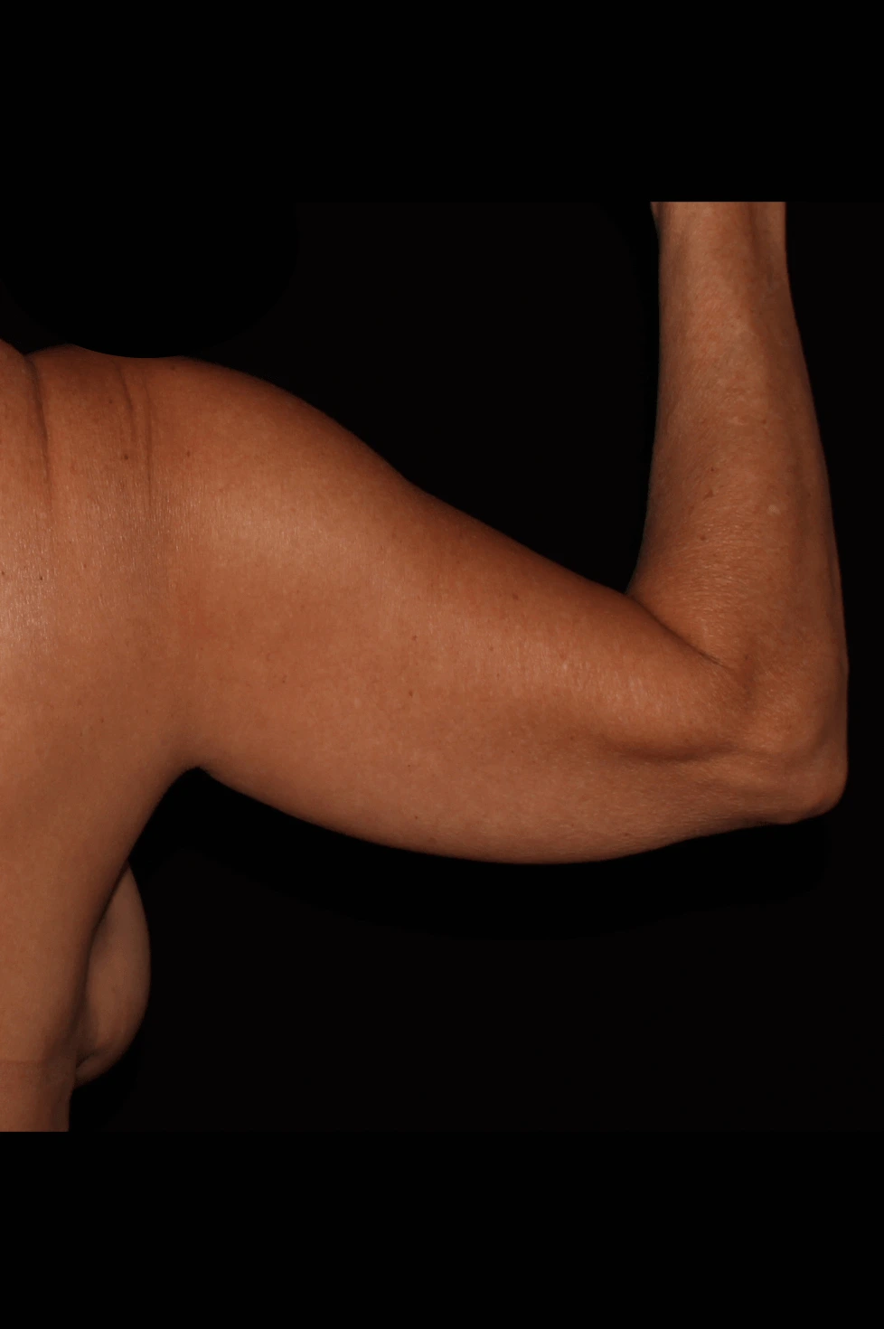 Case #0011221 before