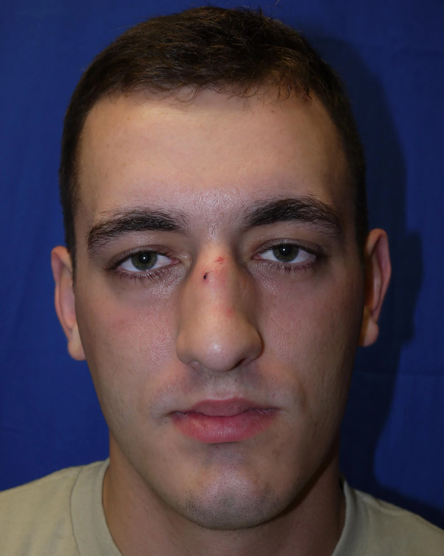 Case #17406 before front