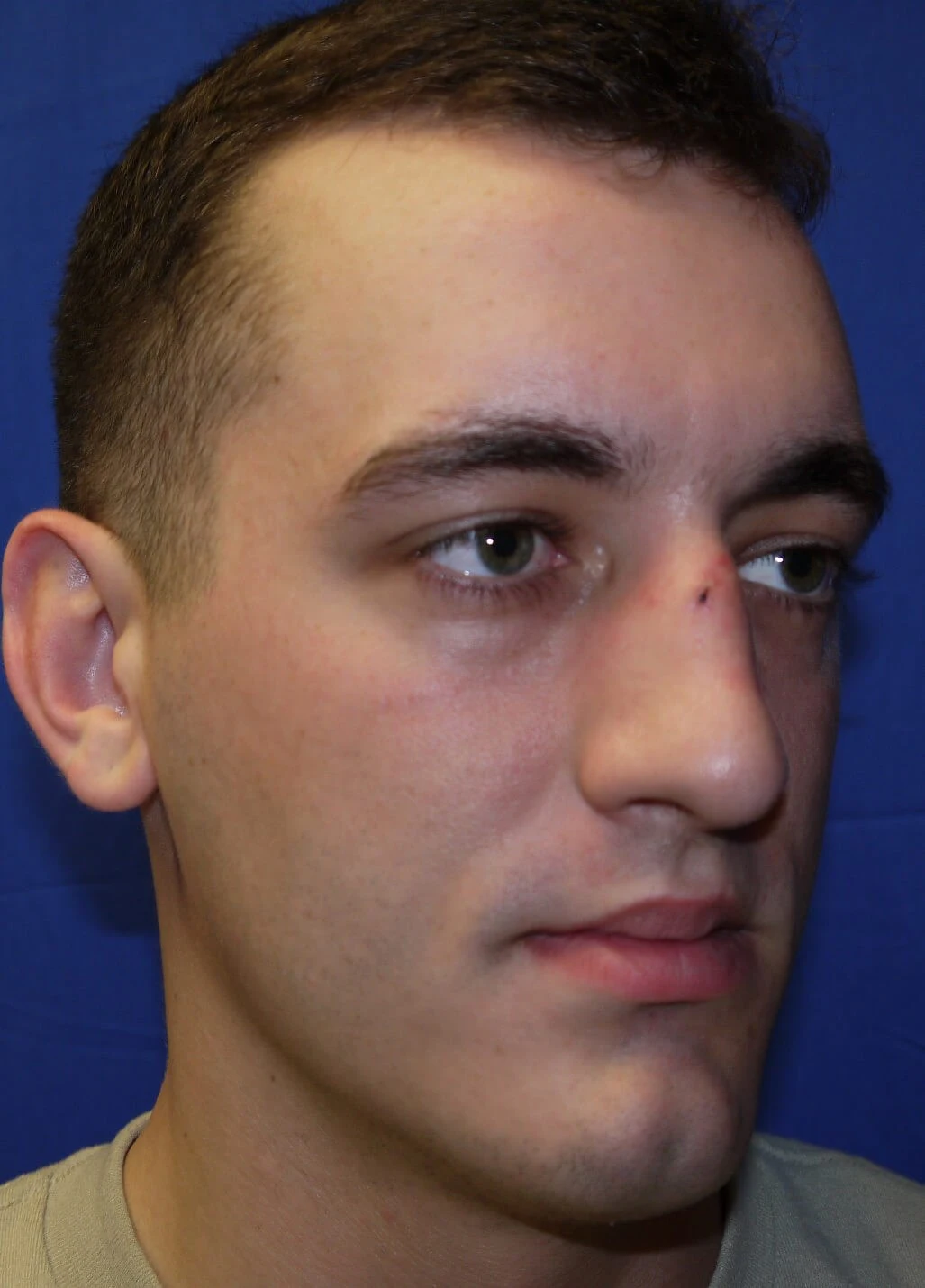 Case #17406 before right lateral