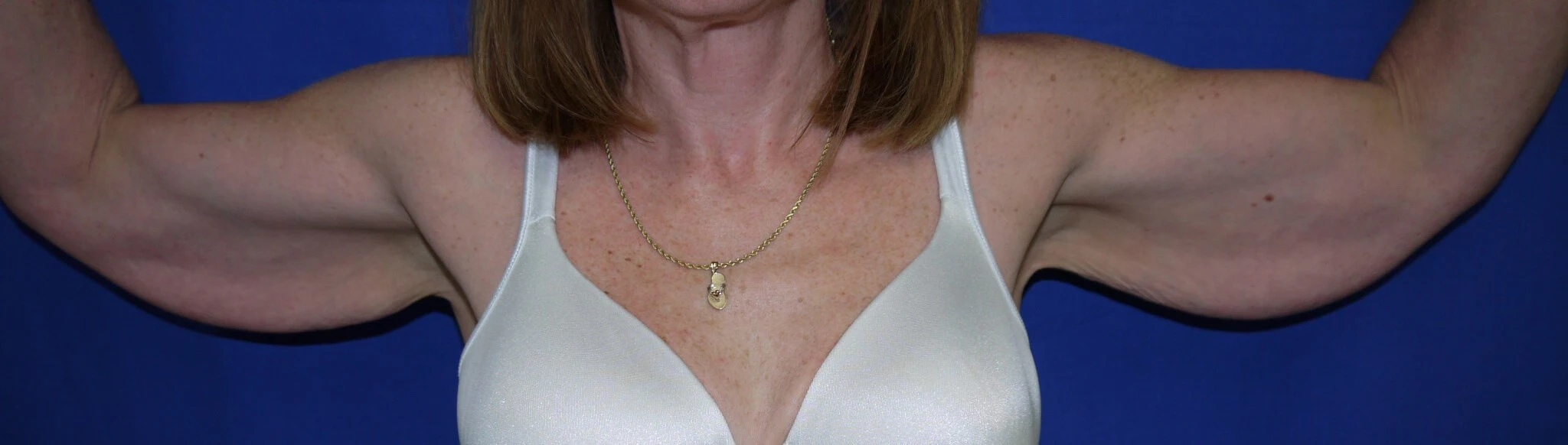 Case #17452 before front