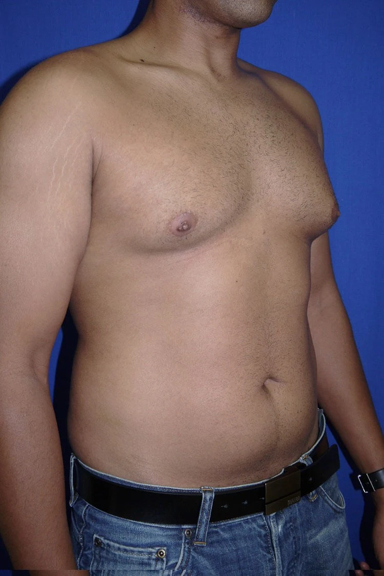 Case #17652 before right oblique