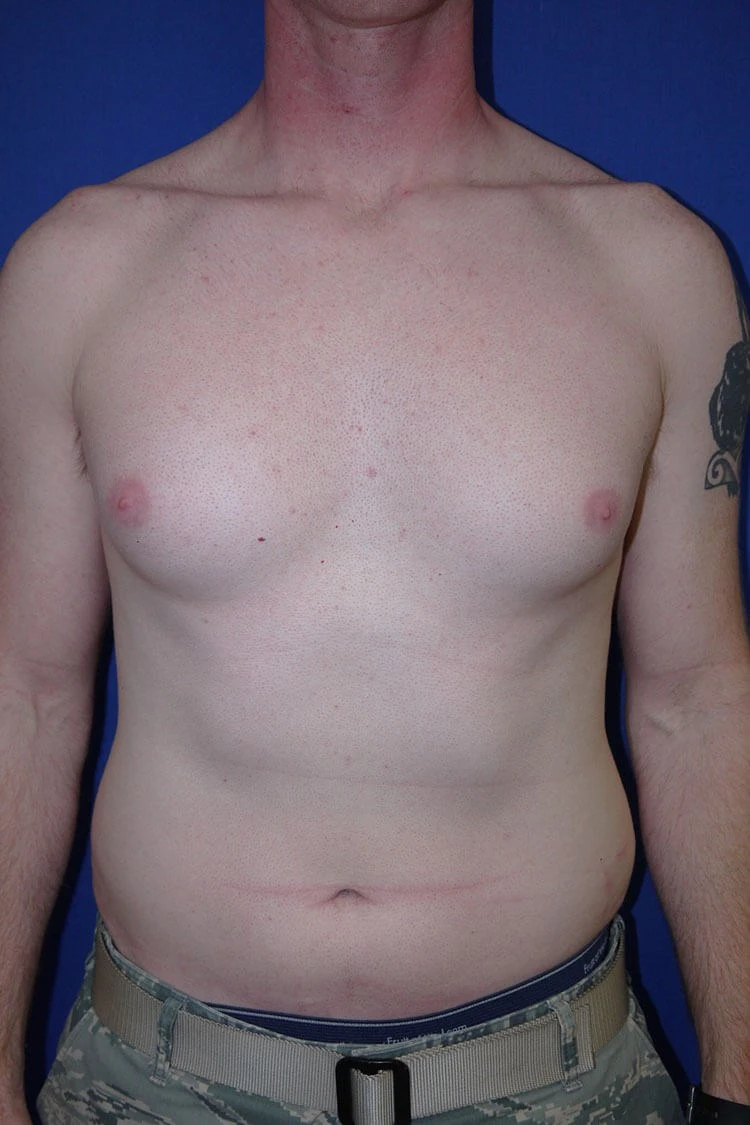 Case #17653 before front