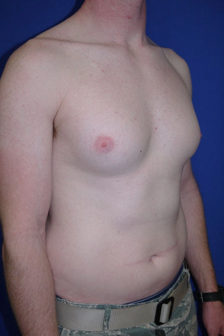 Case #17653 before right oblique