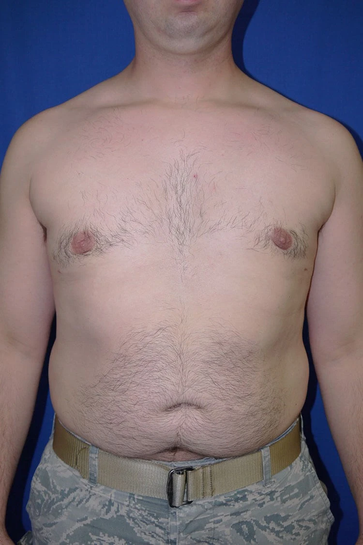 Case #17656 After front