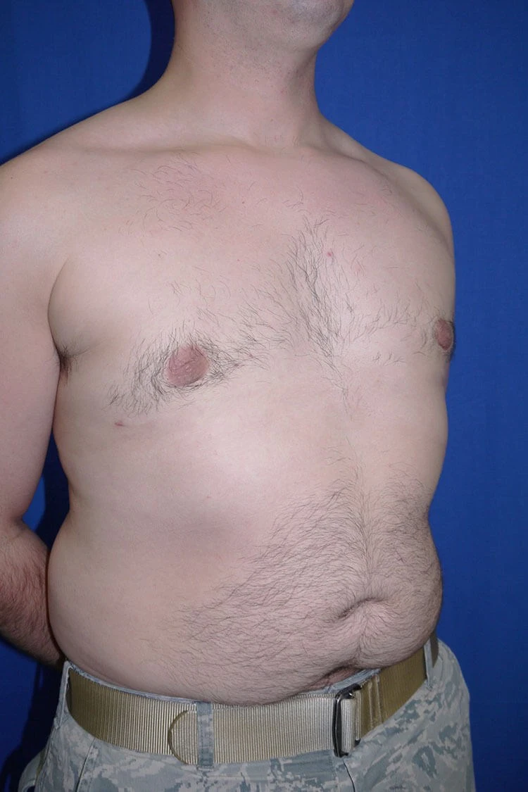 Case #17656 After right oblique