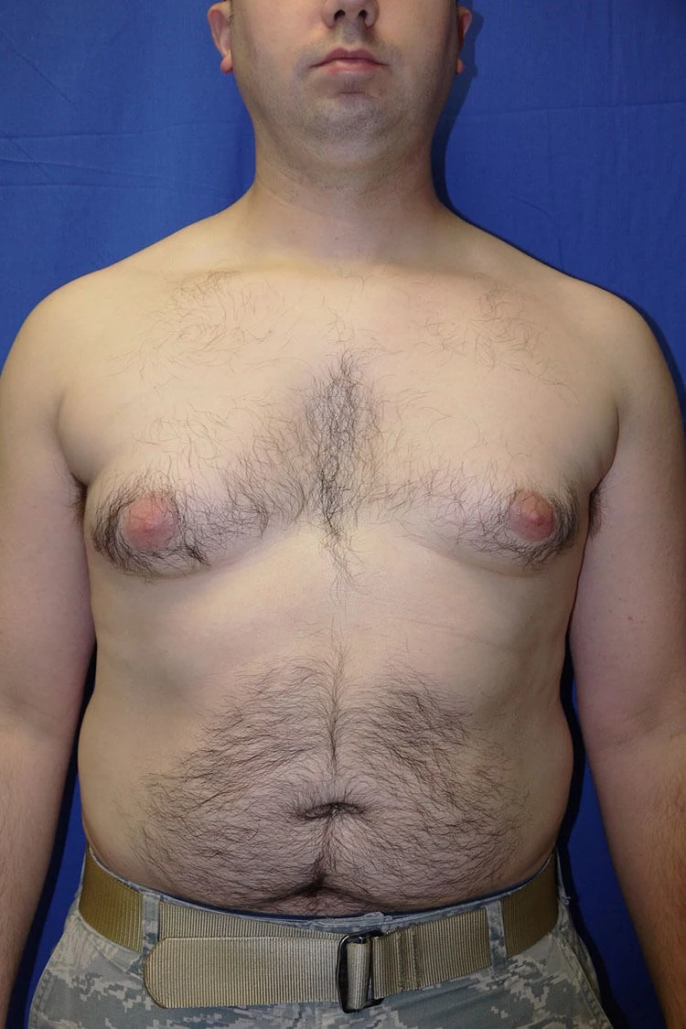 Case #17656 before front