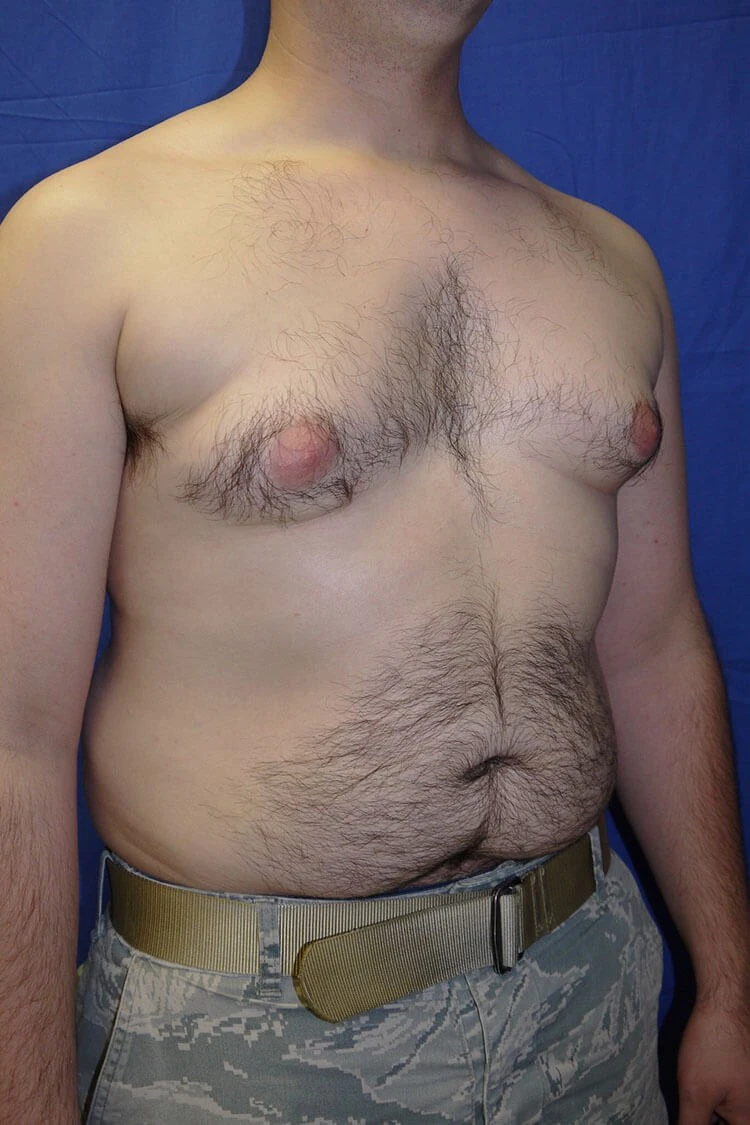 Case #17656 before right oblique