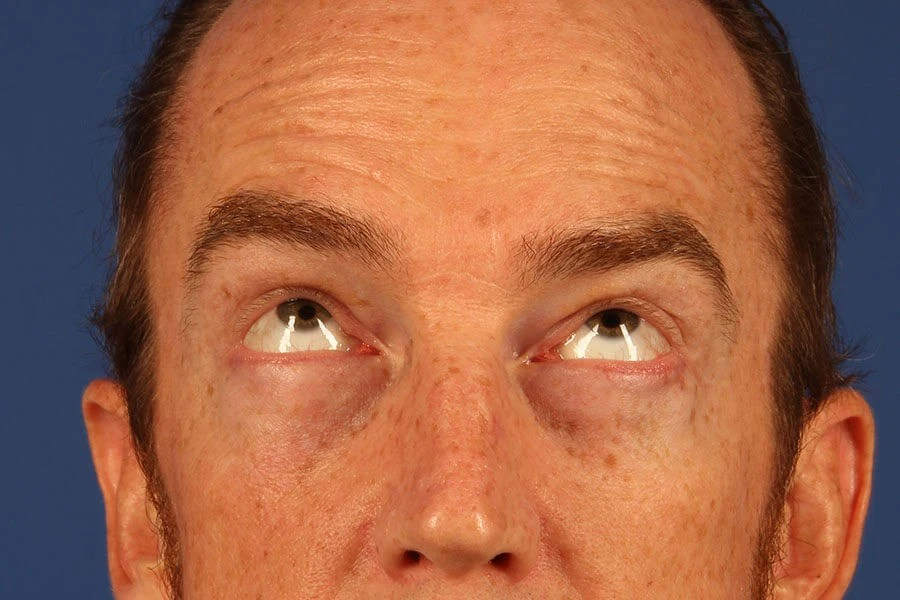 Case #17660 after front