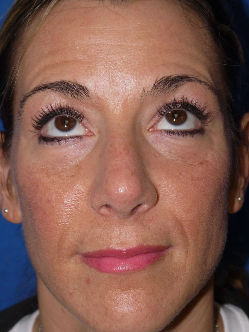 Case #18618 before front