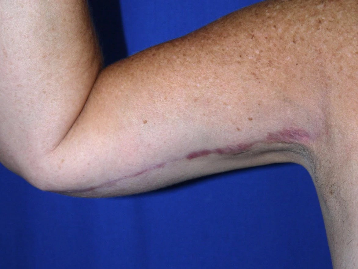 Case #18775 After front right