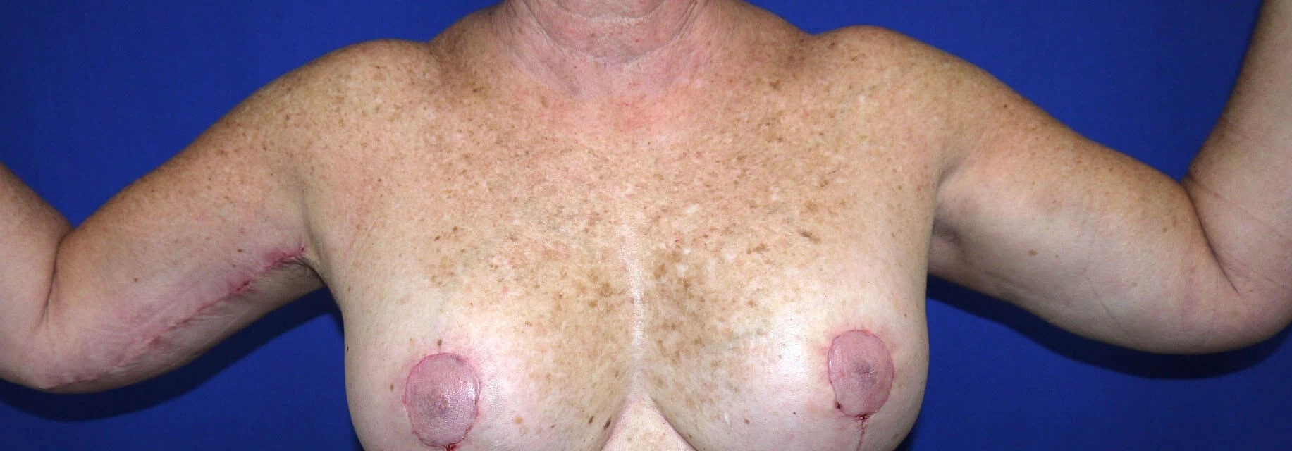 Case #18775 After front