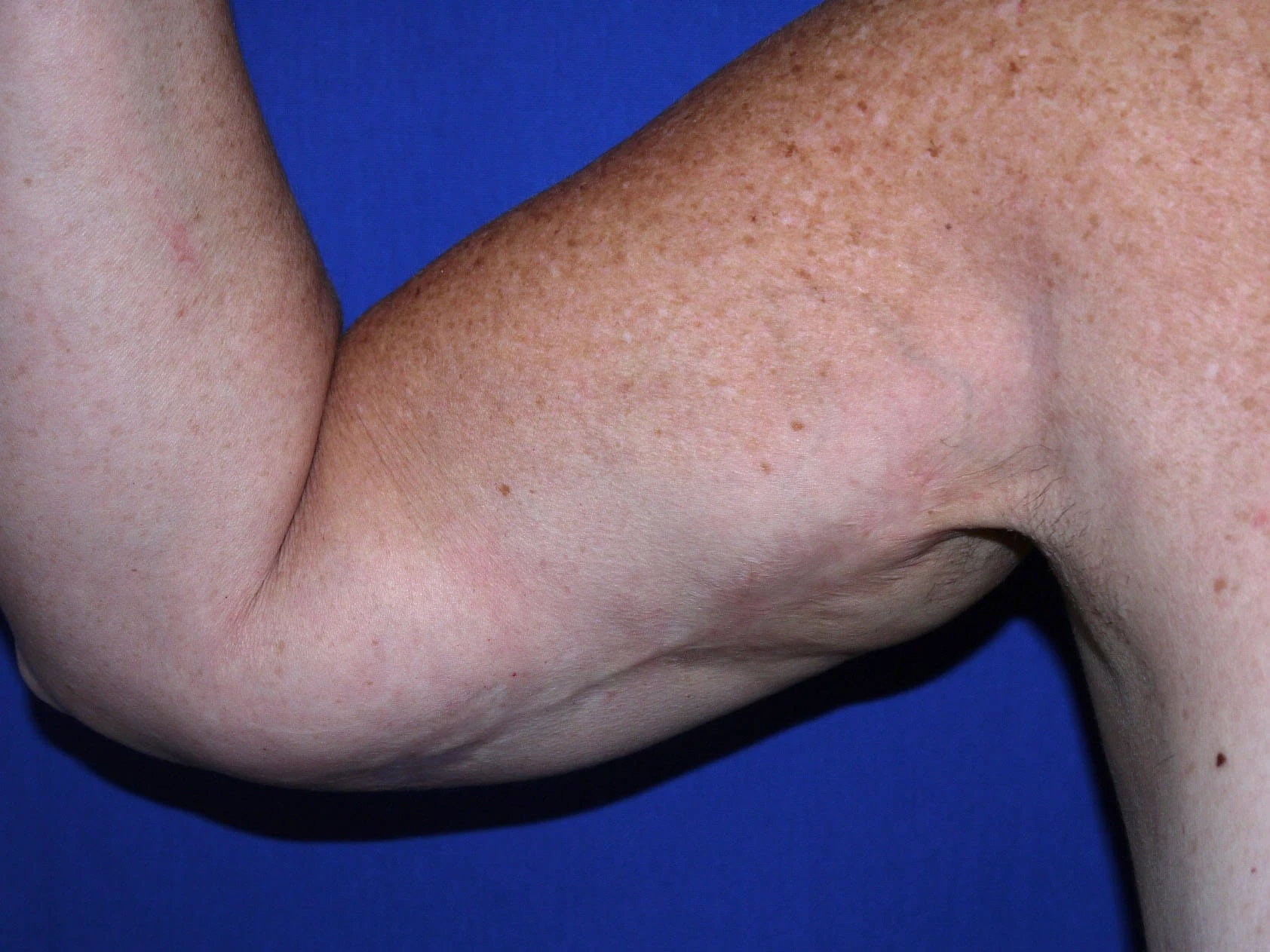 Case #18775 Before front right