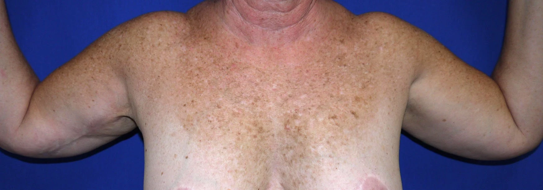 Case #18775 Before front