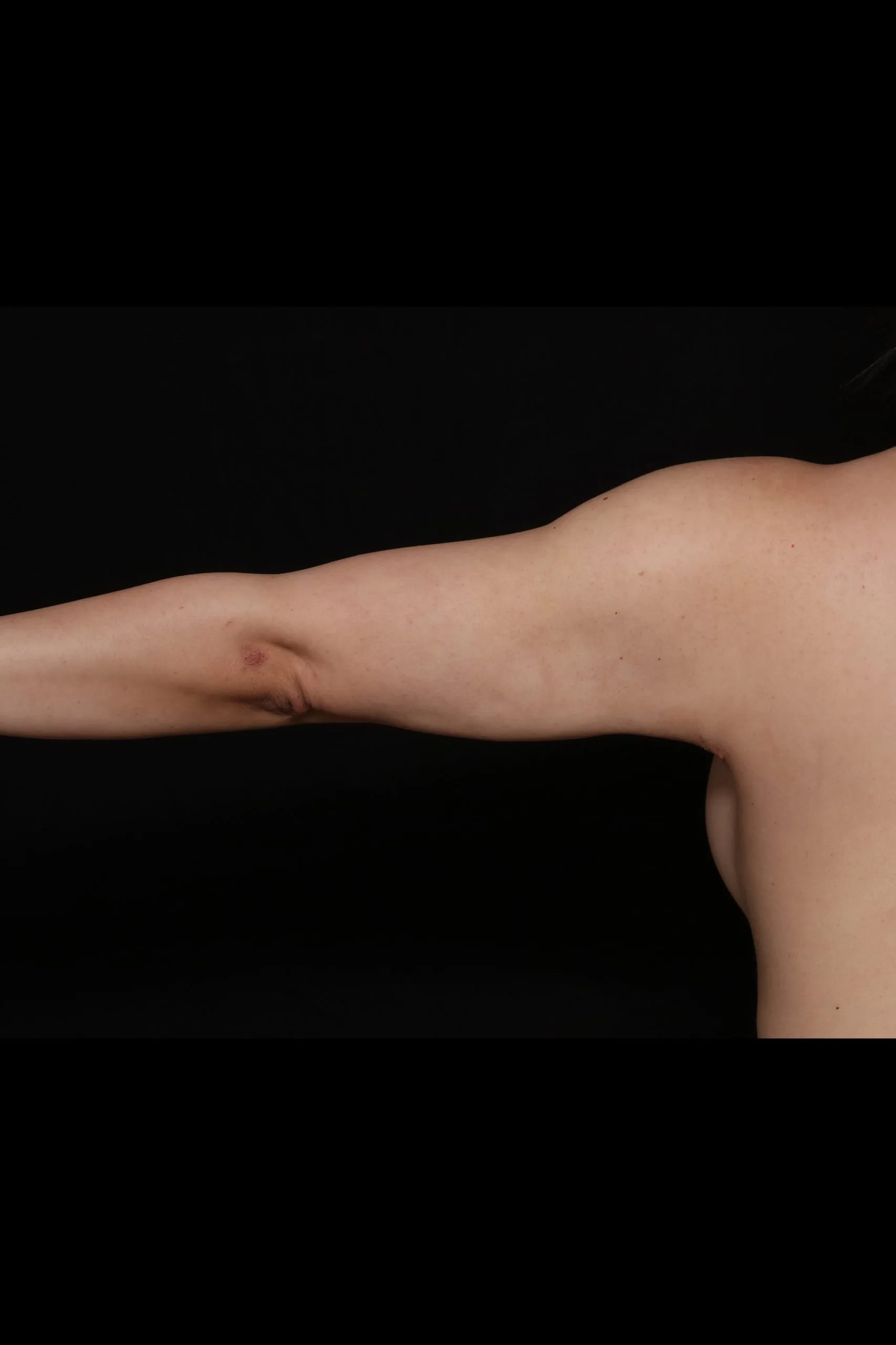 Case #19834 back_after