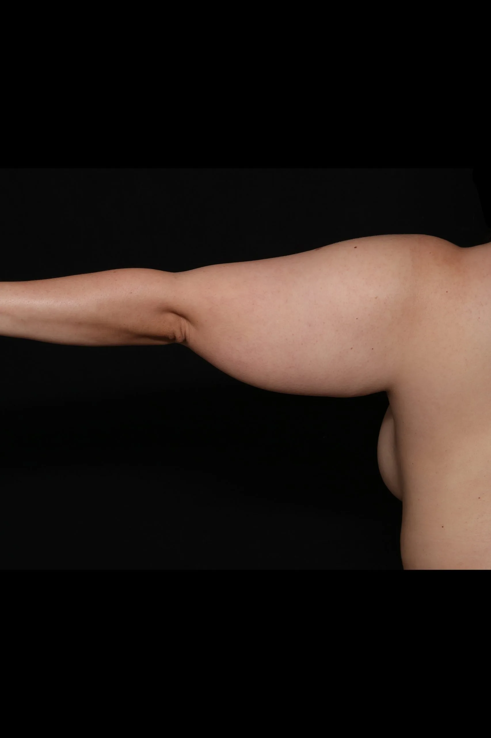 Case #19834 back_before