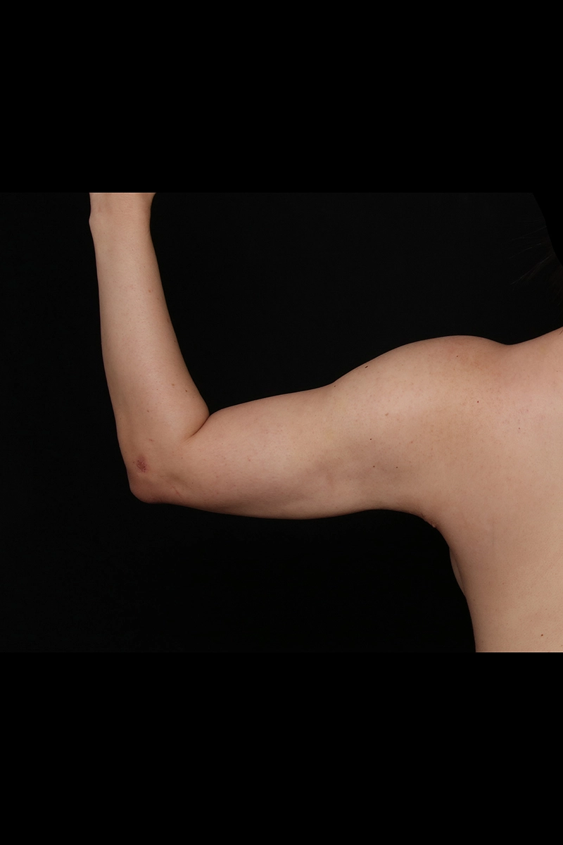 Case 19834_after_opt