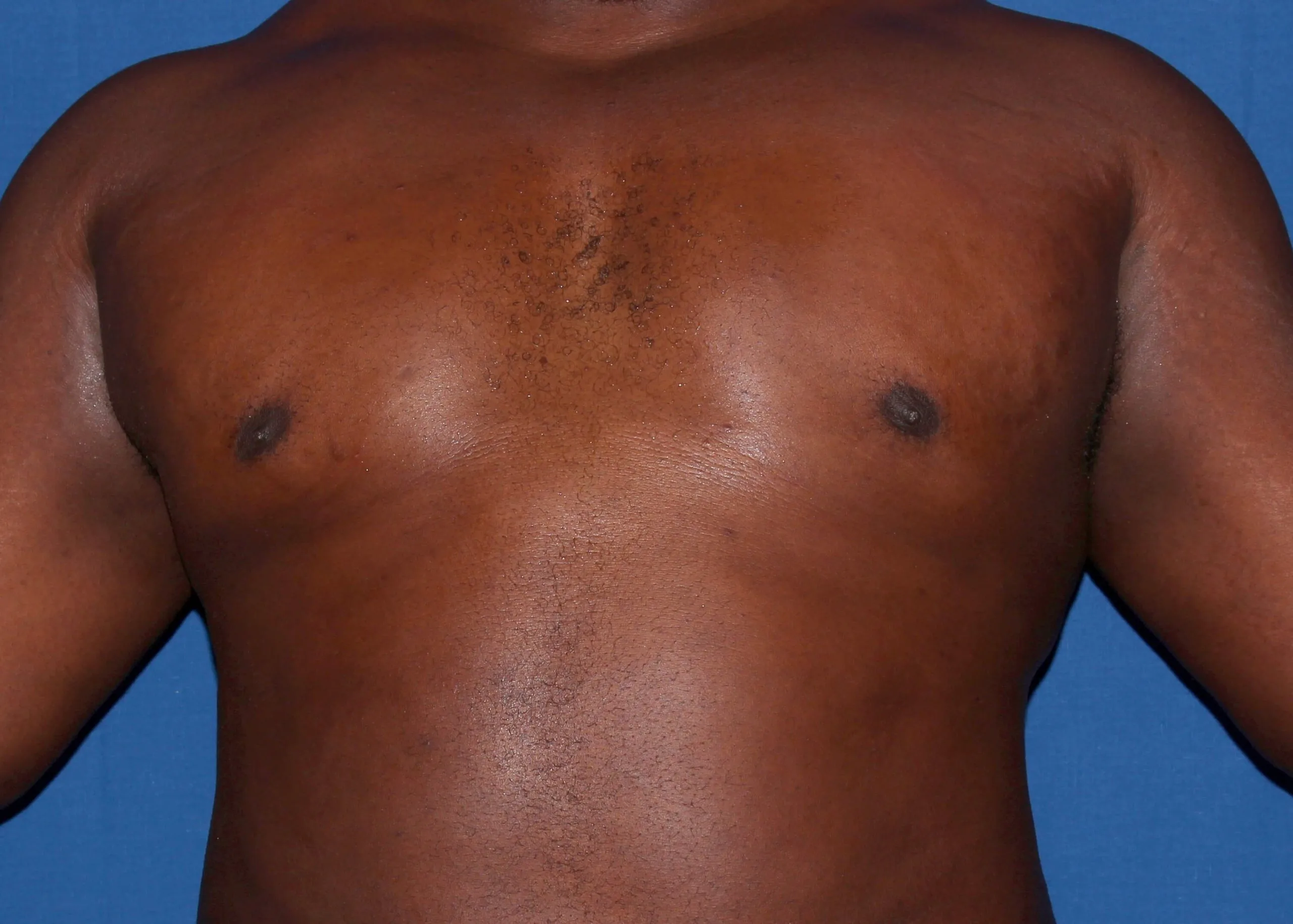 Case #34984 After front