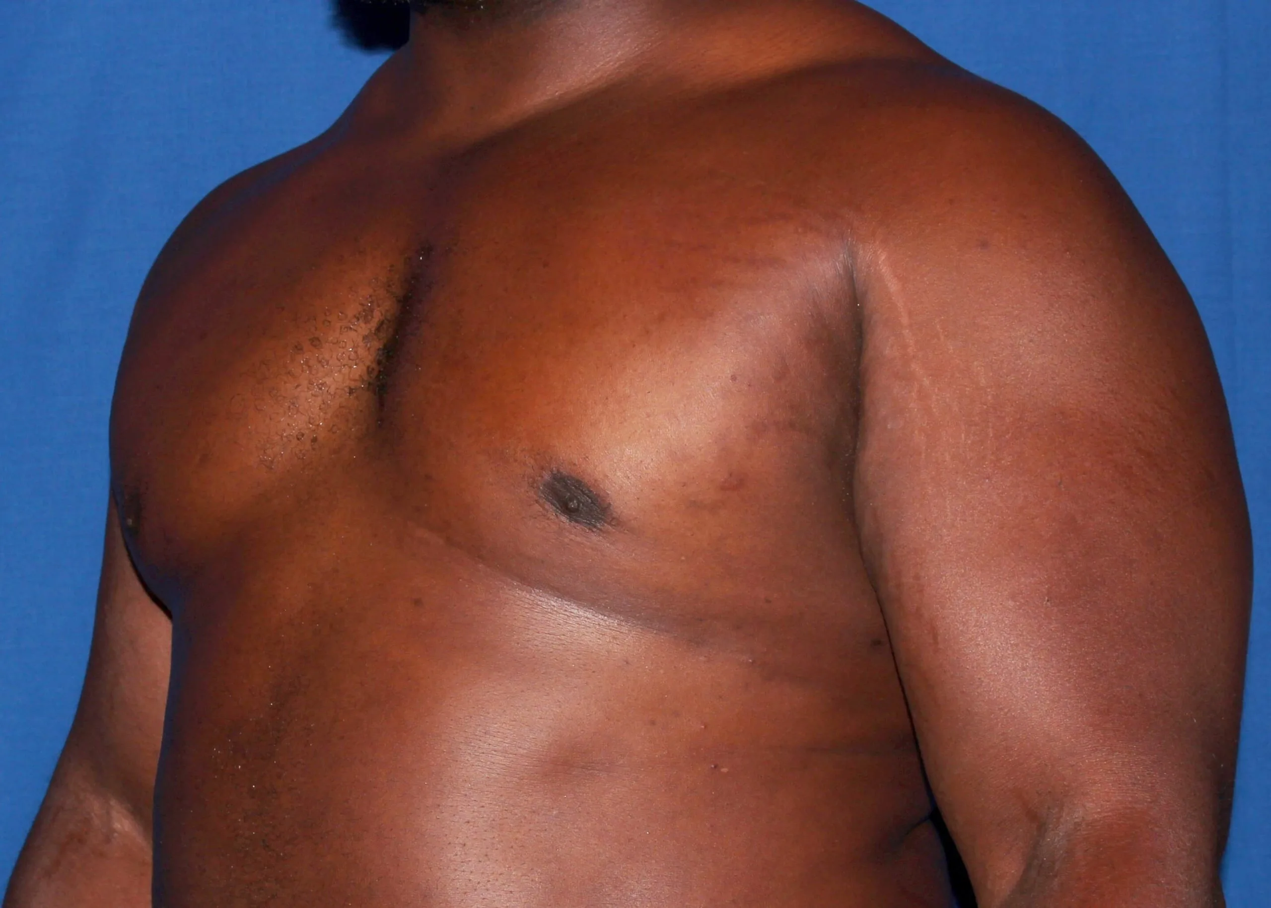 Case #34984 After left oblique