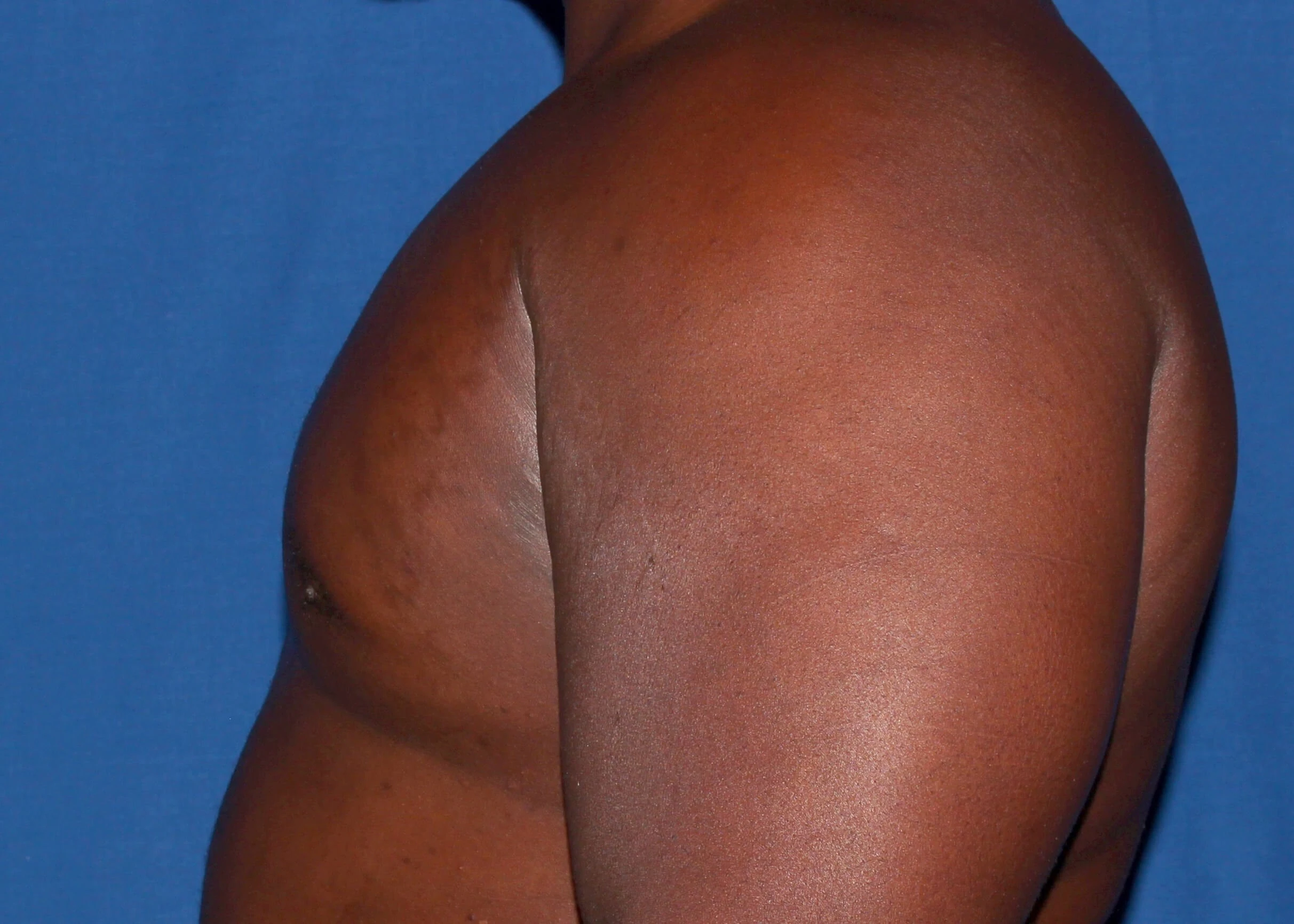 Case #34984 After left