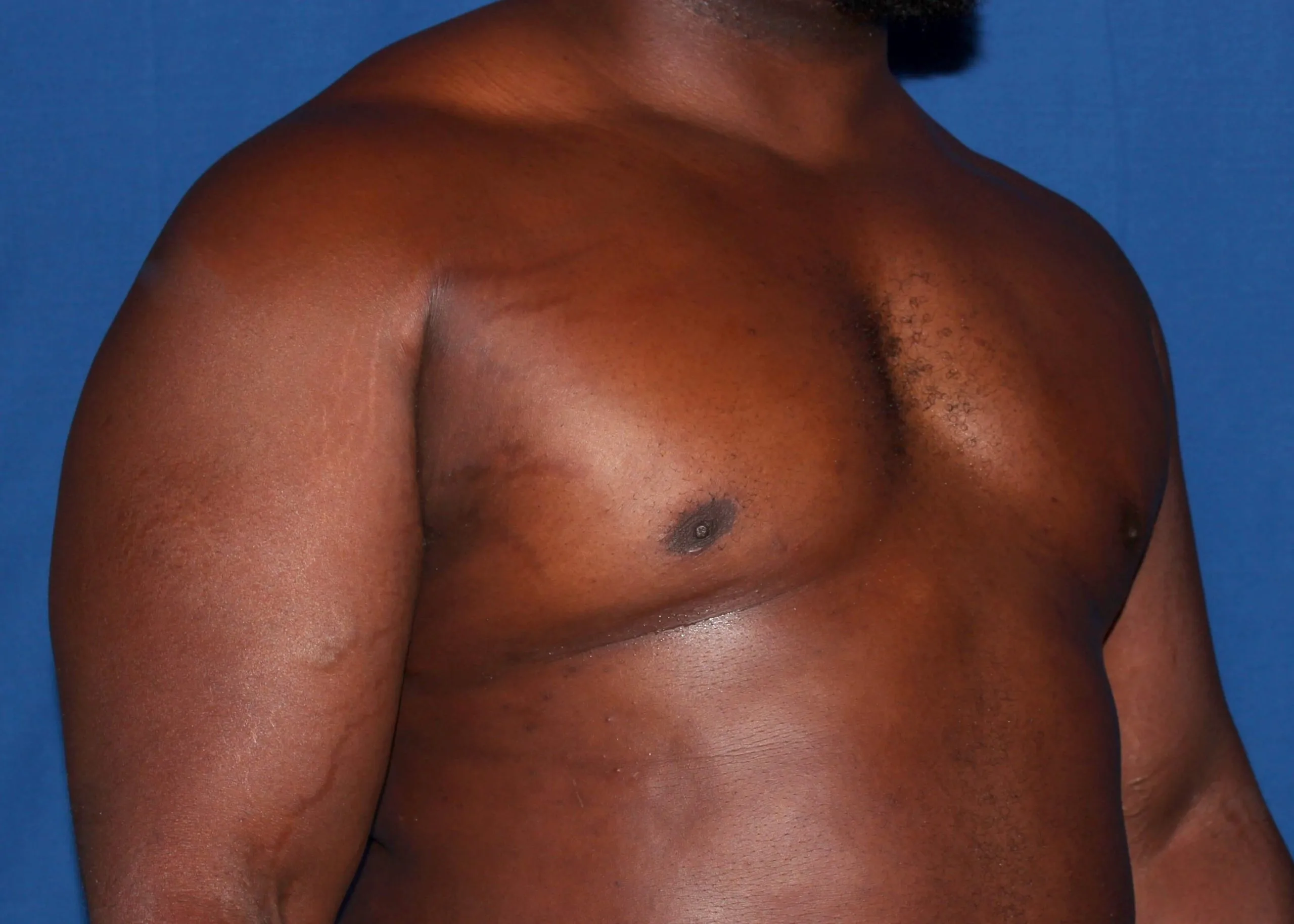 Case #34984 After right oblique