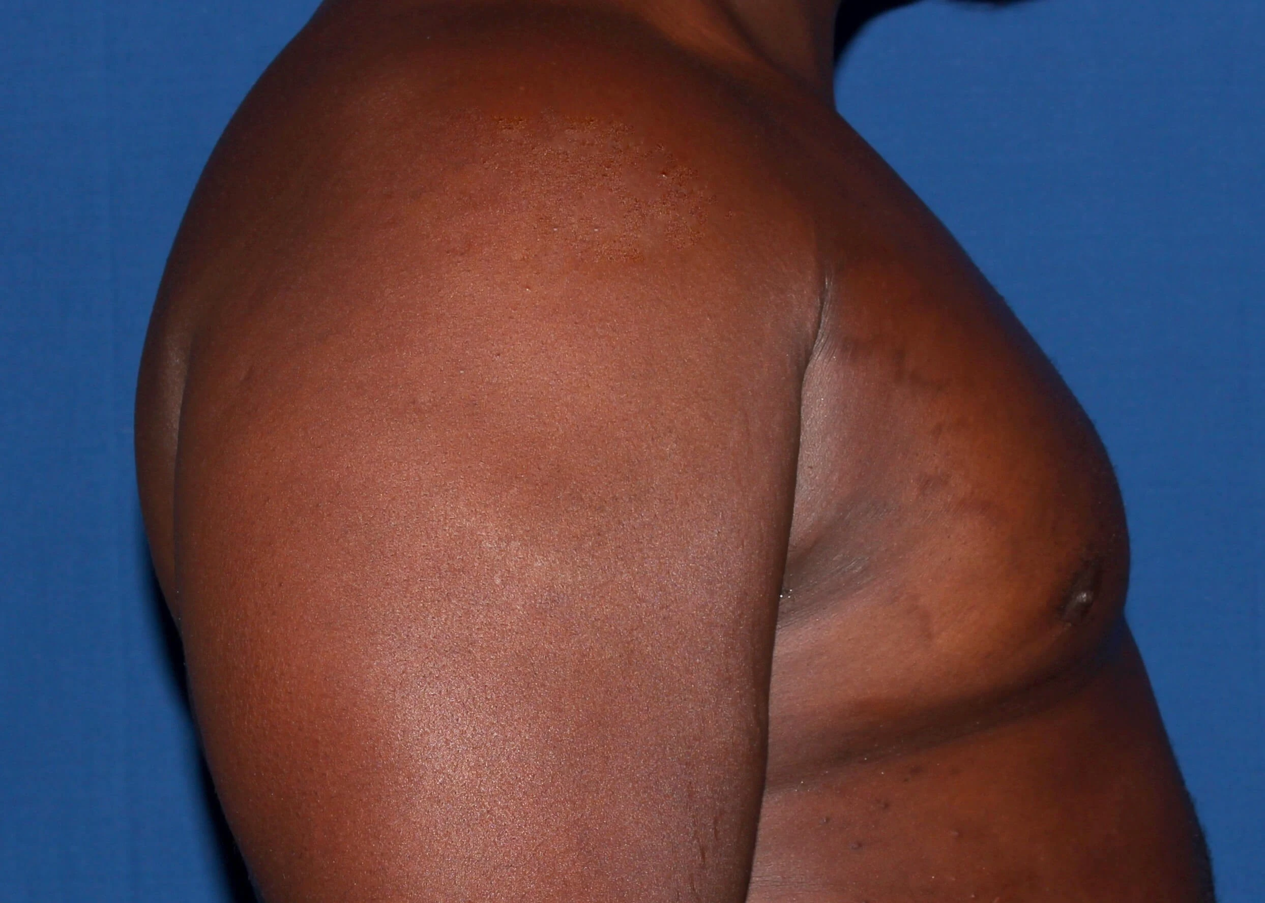 Case #34984 After right