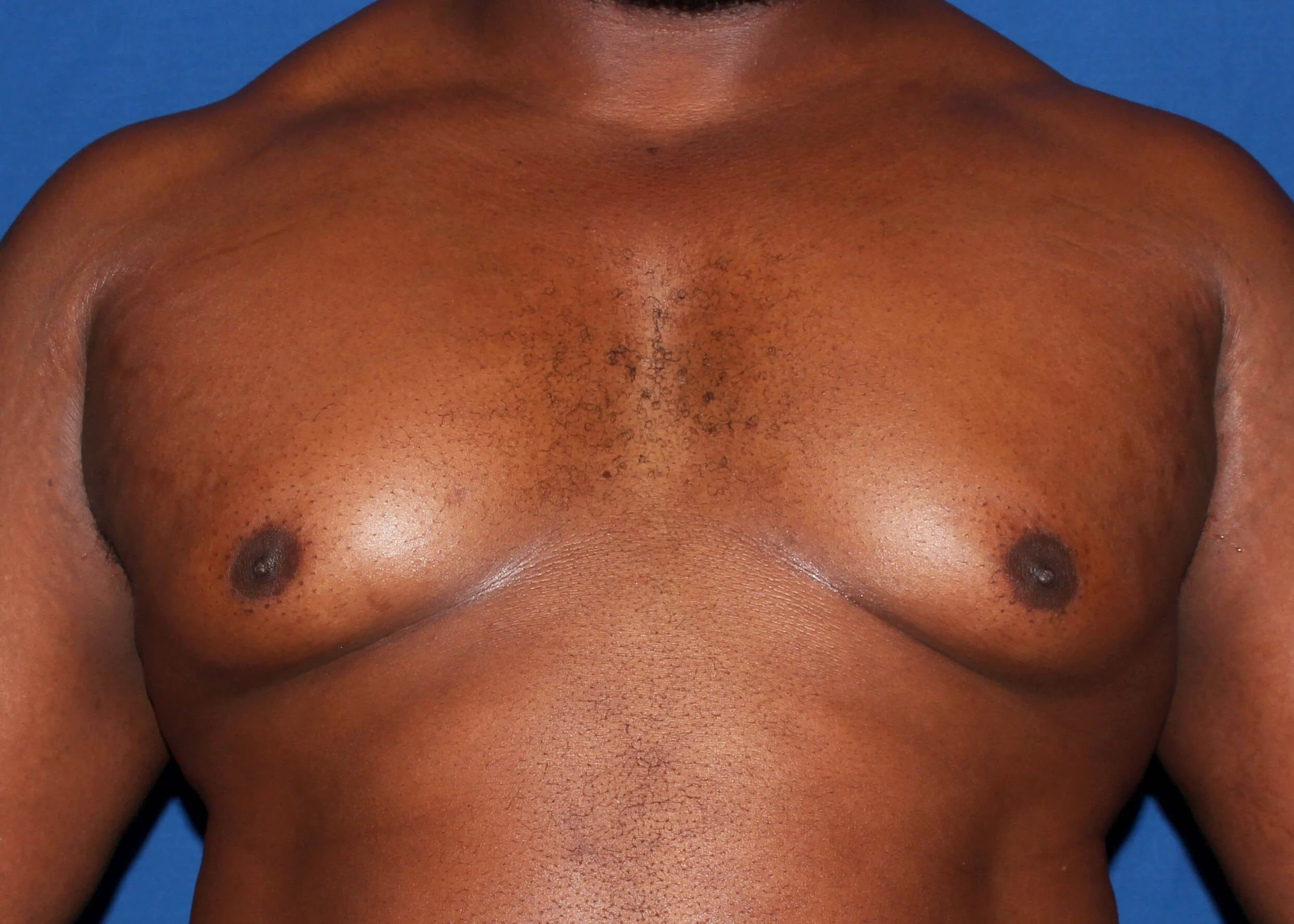 Case #34984 before front