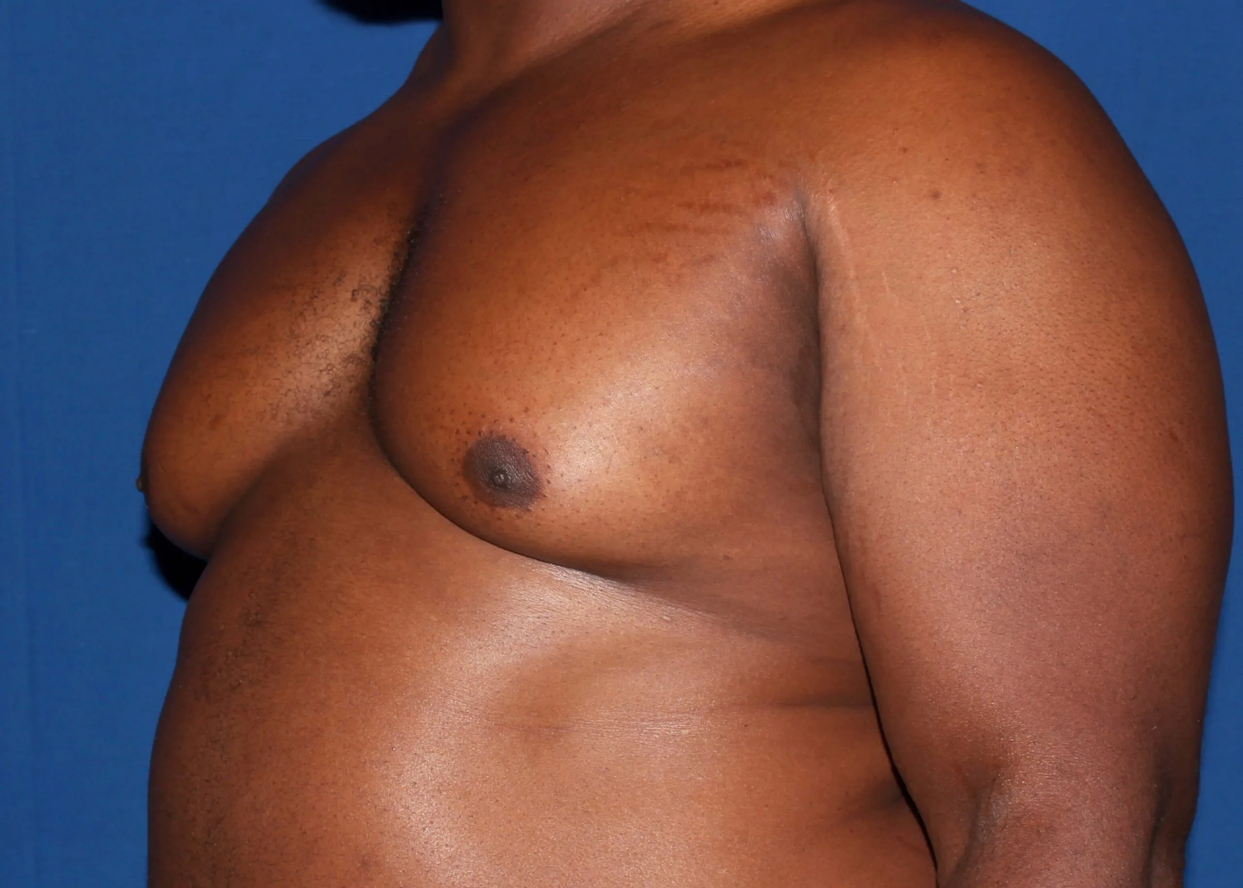 Case #34984 before left oblique