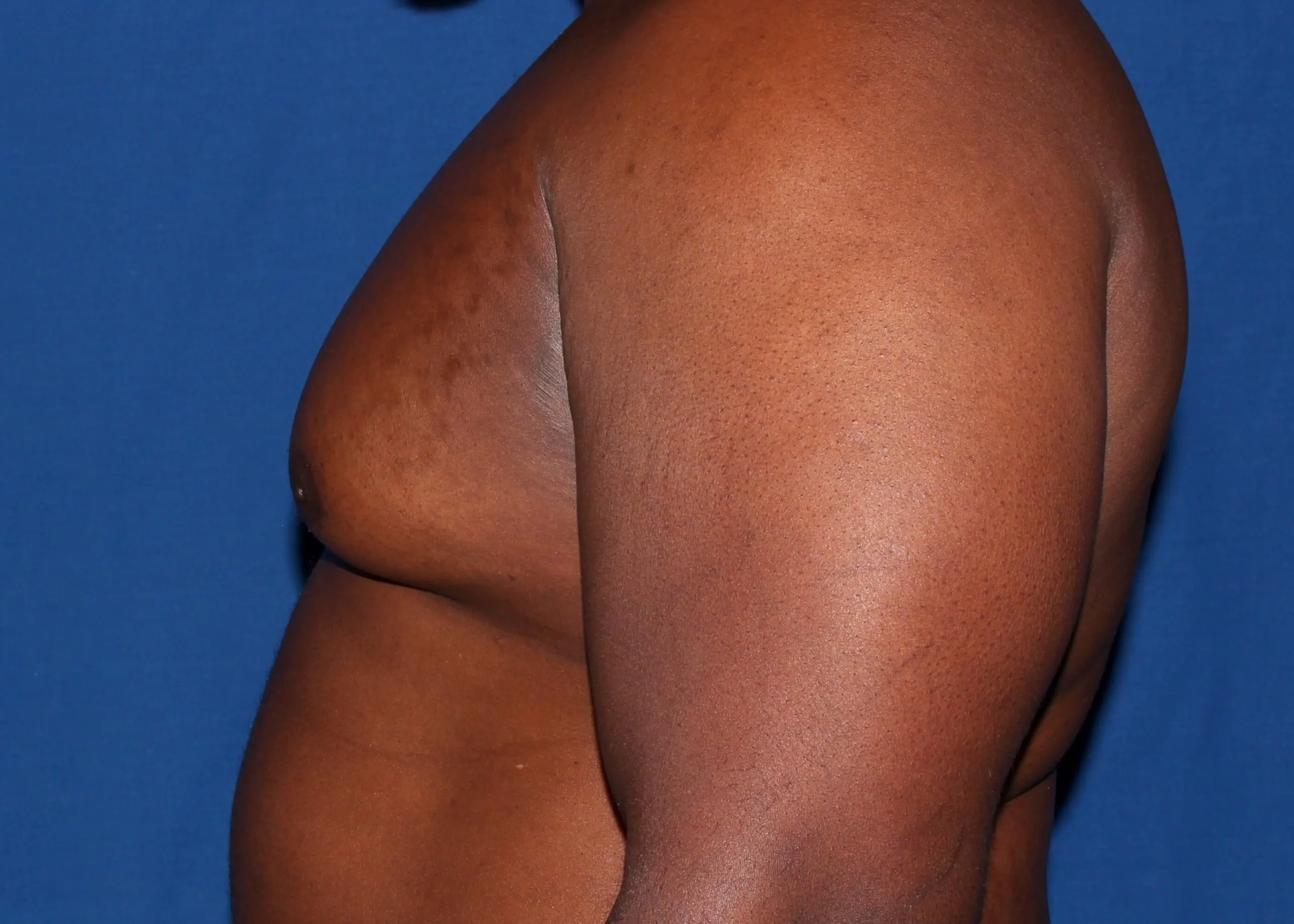 Case #34984 before left