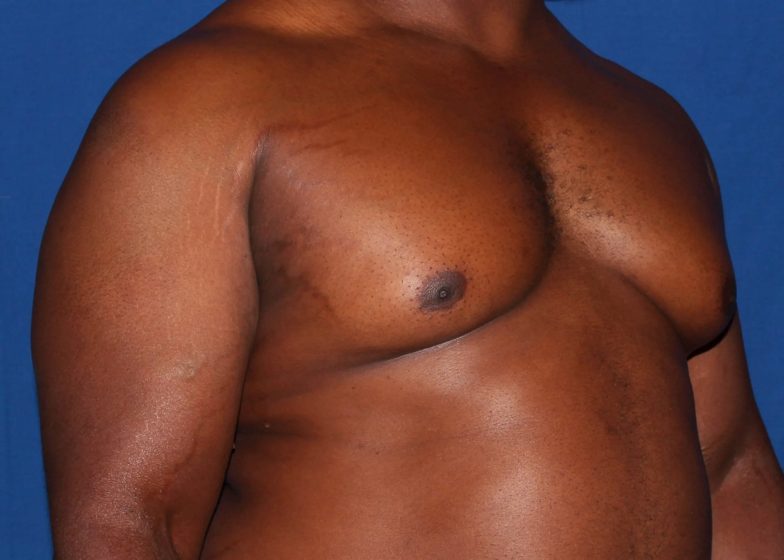 Case #34984 before right oblique