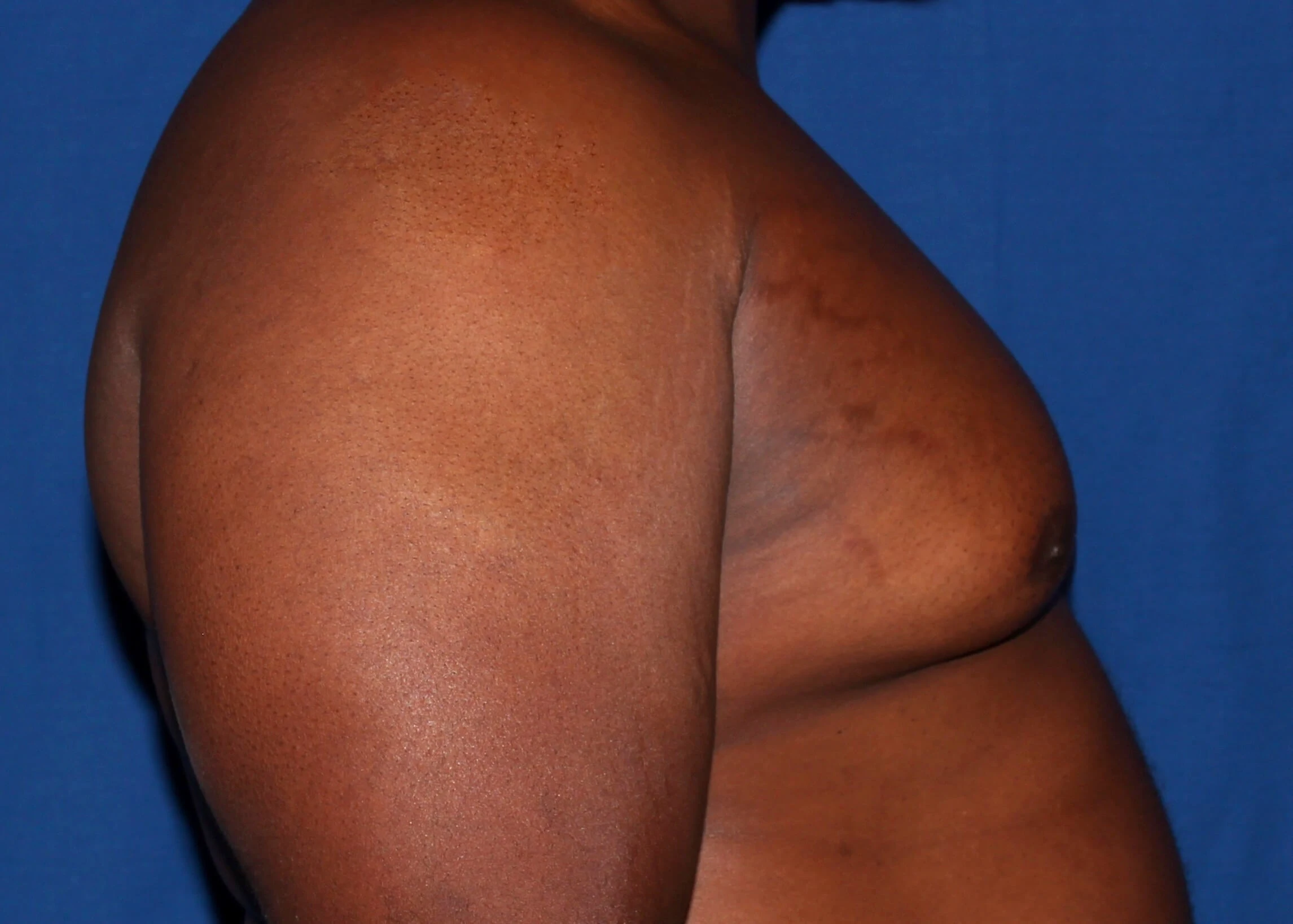 Case #34984 before right