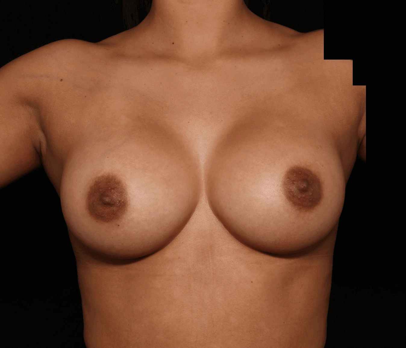 Case #472943 After front