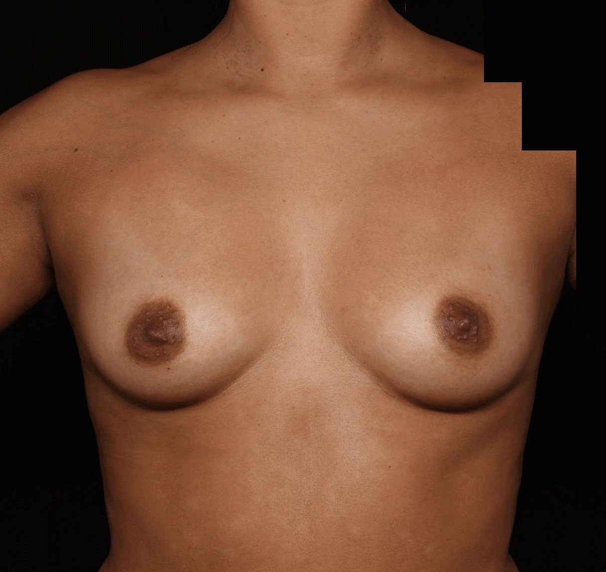 Case #472943 before front