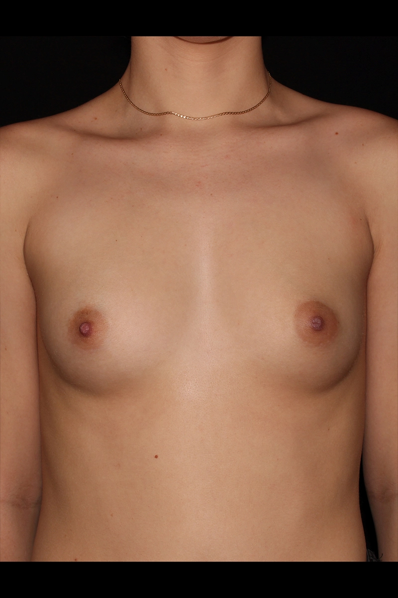 Case #5094 before_opt