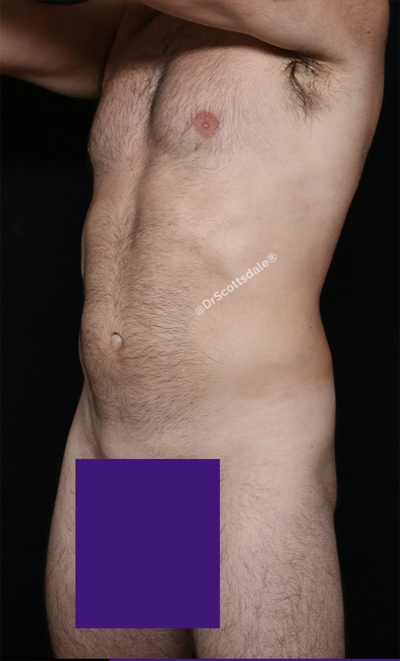 Case #724311 after_opt