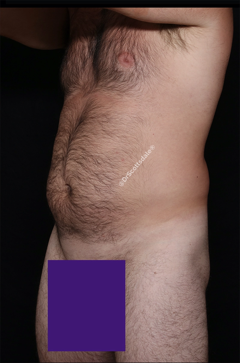 @naturalresultsaz before_opt