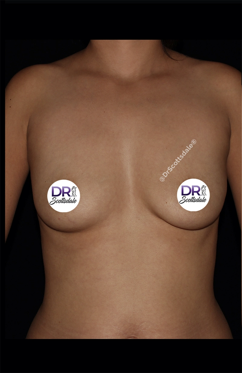 Case #746294 before_opt