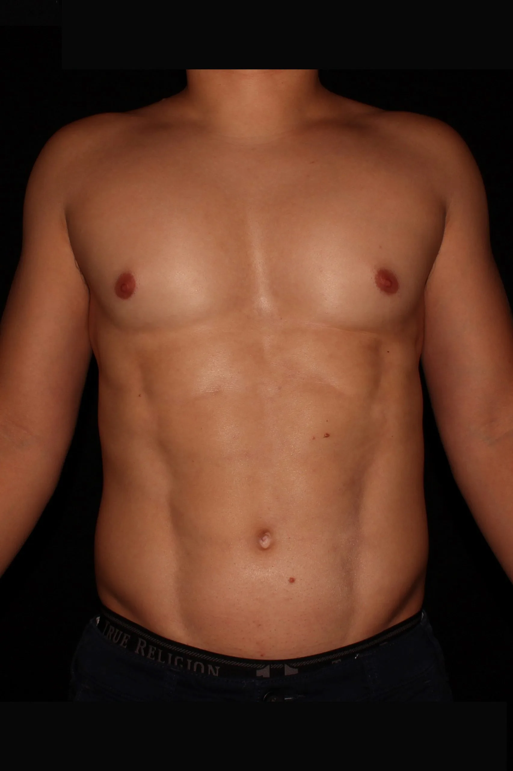 Gladiator 5244_after_front