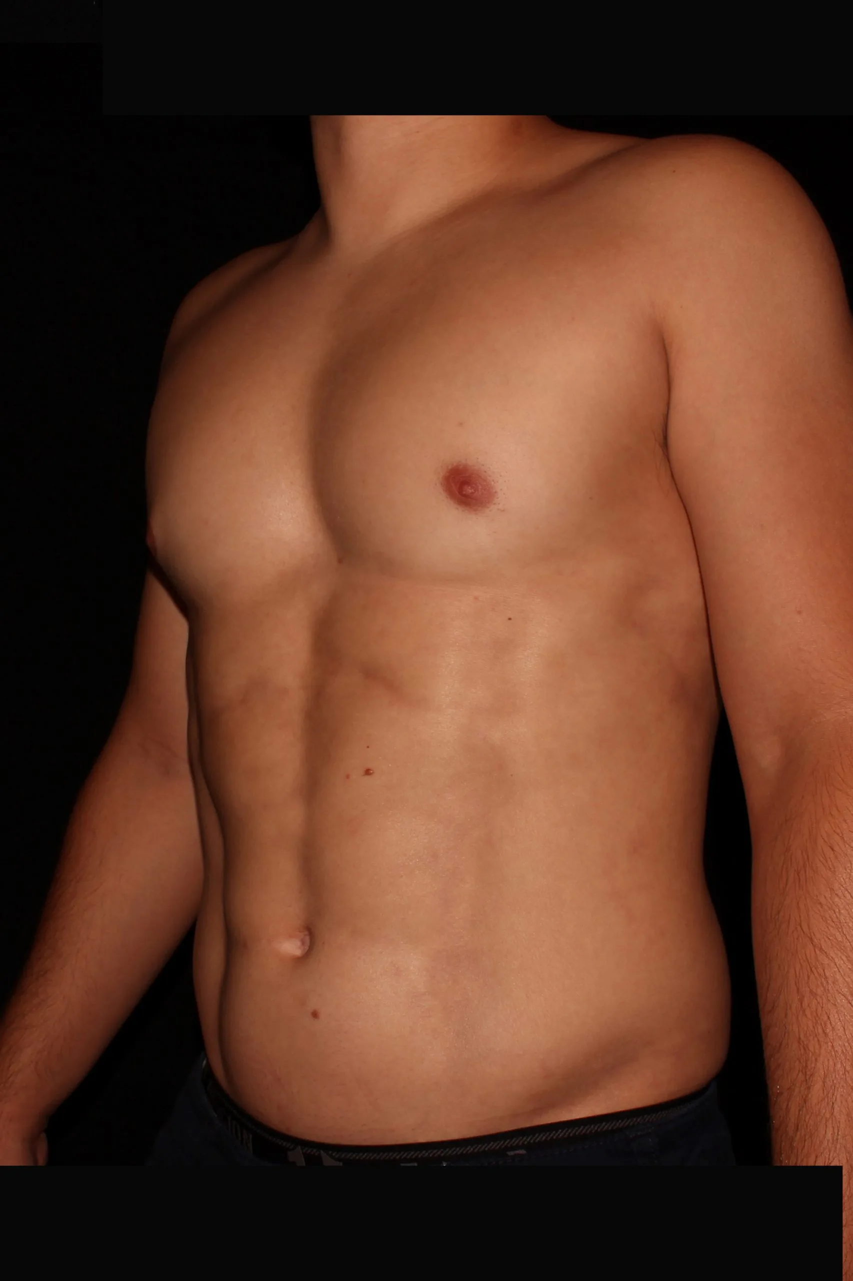 Gladiator 5244_after_oblique