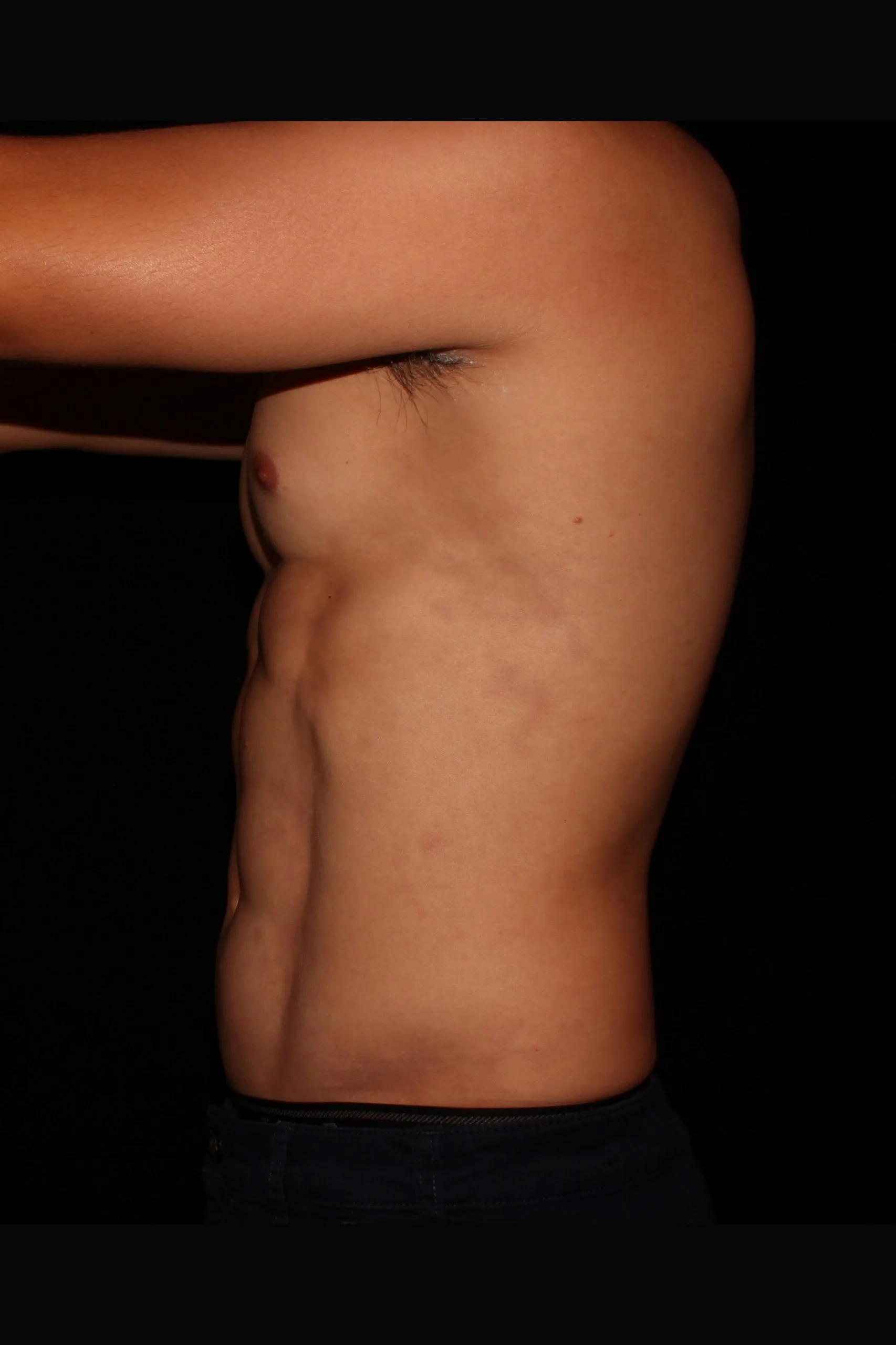 Gladiator 5244_after_side