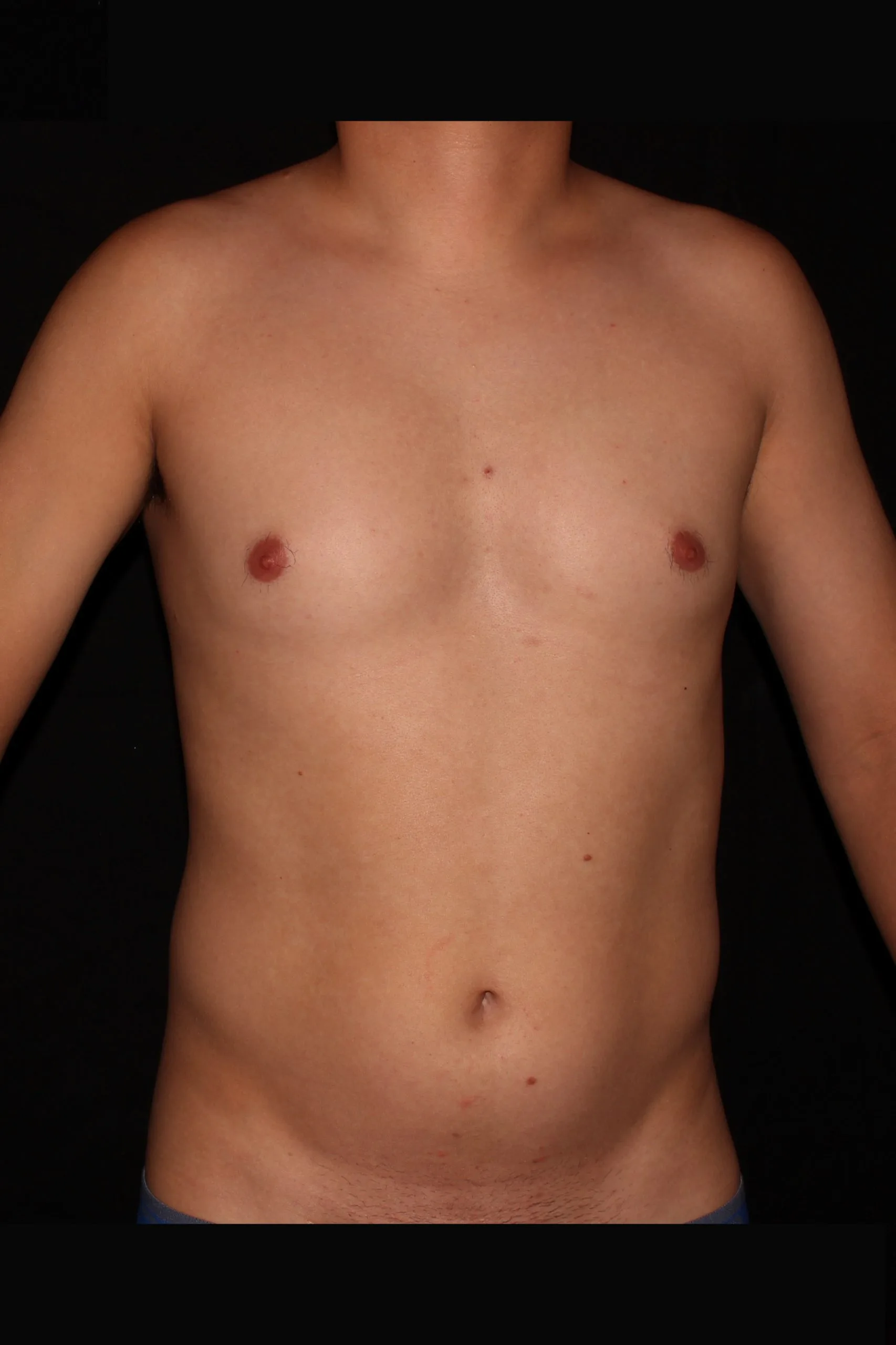 Gladiator 5244_before_front