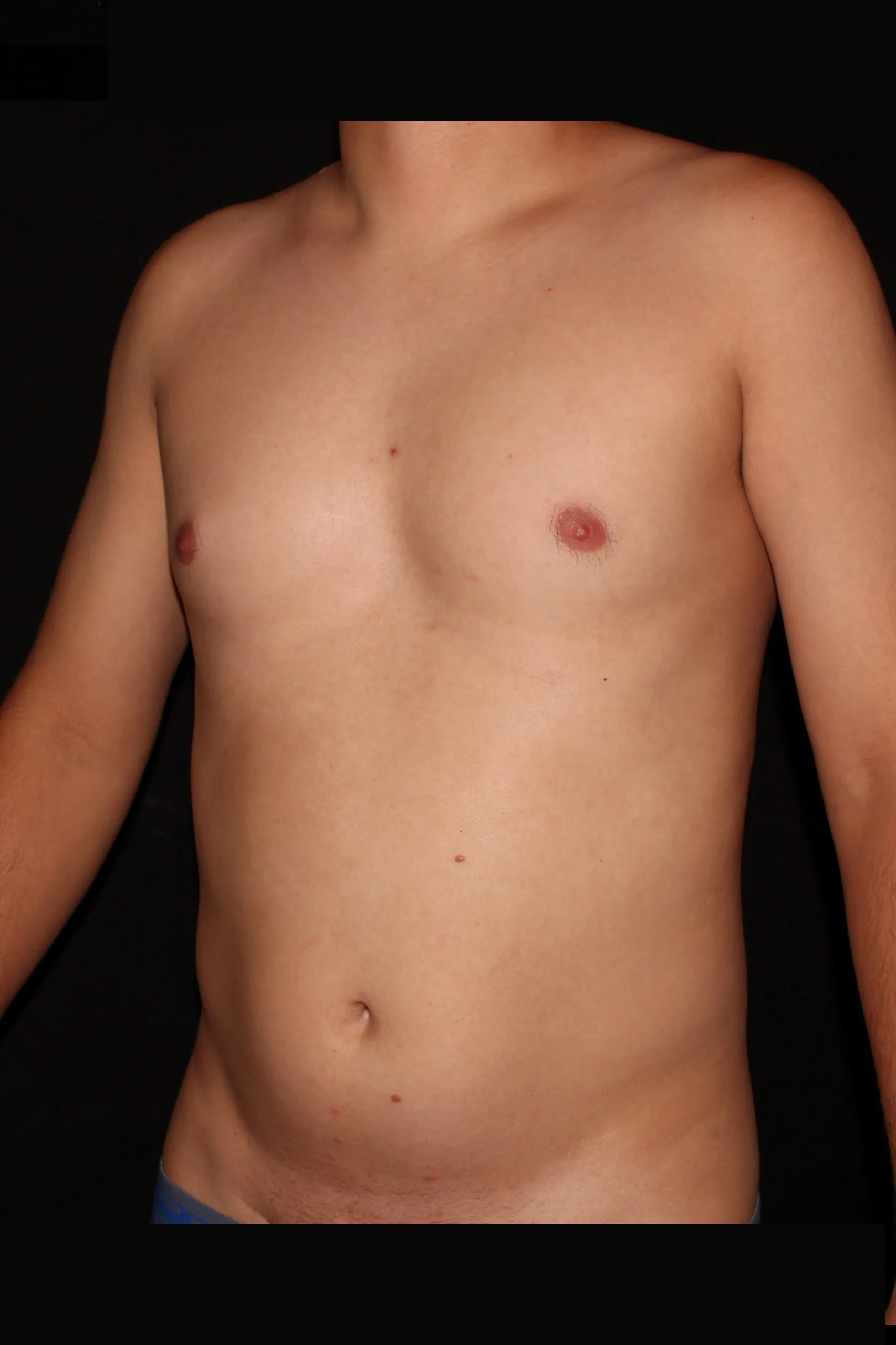 Gladiator 5244_before_oblique