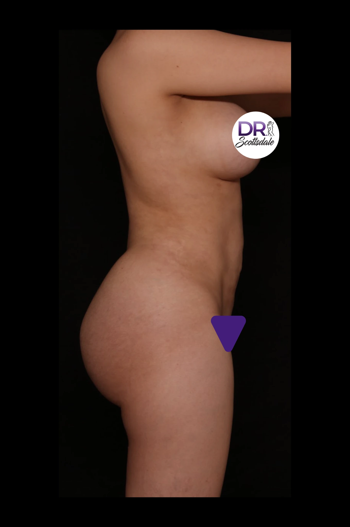 Scottsdale Skinny After side 5783569