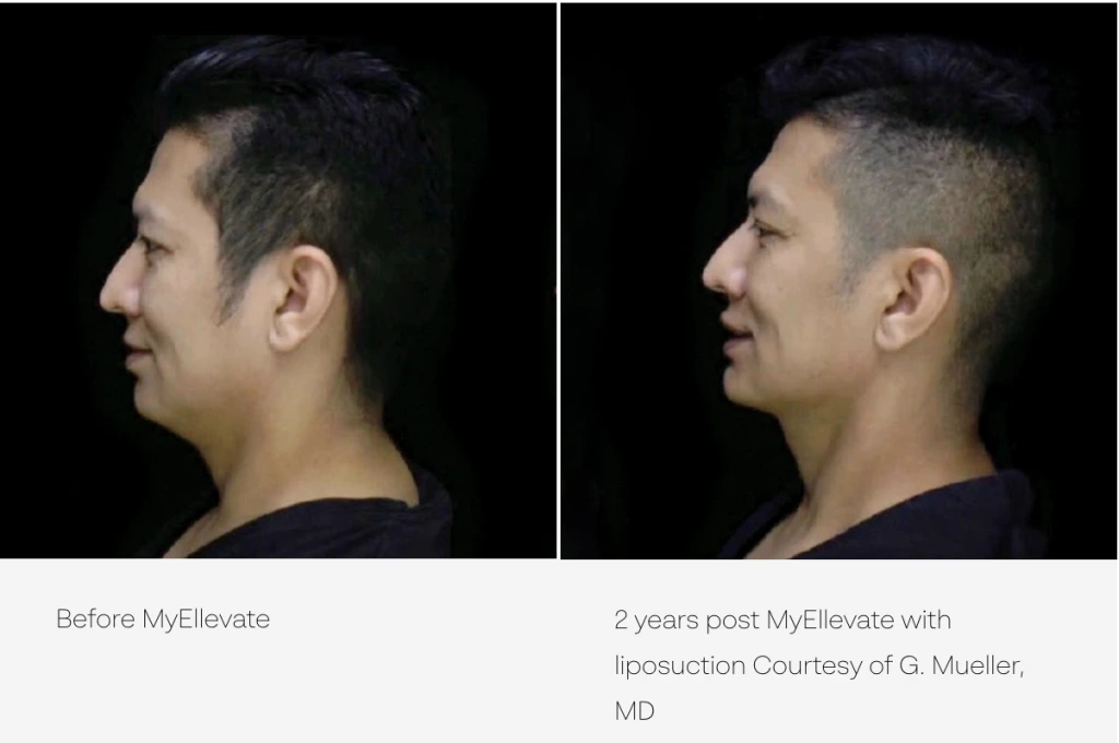 Screen Shot 2024-01-01 at 2.06.00 PM