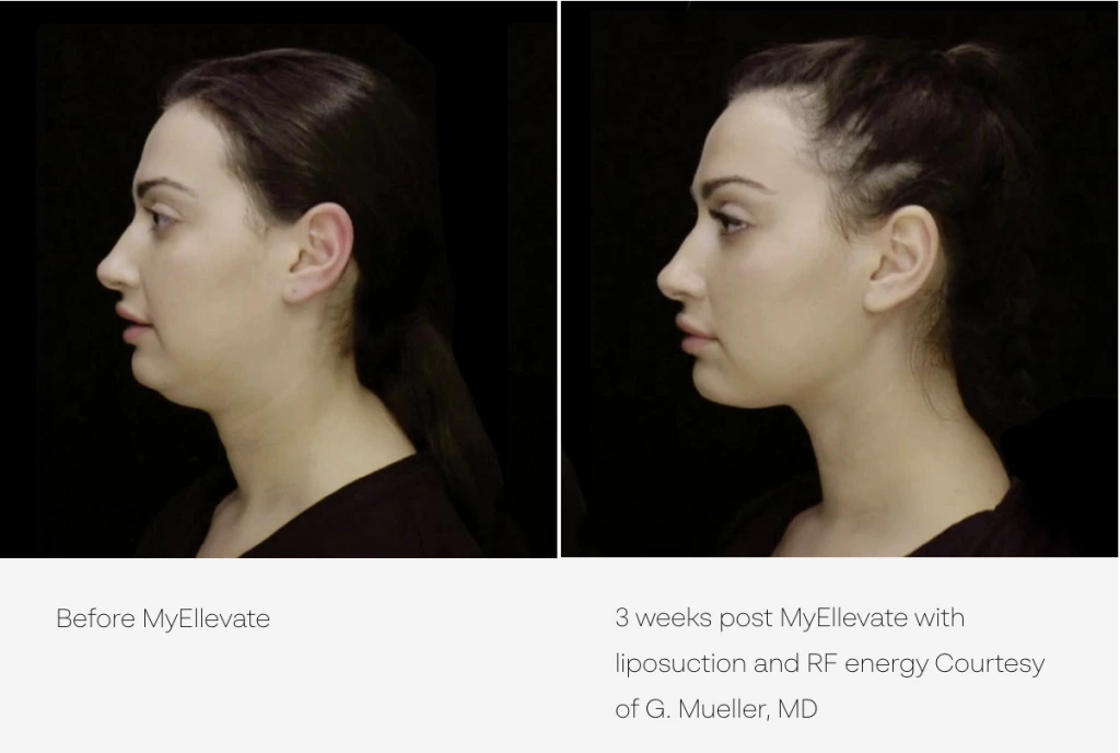 Screen Shot 2024-01-01 at 2.06.09 PM