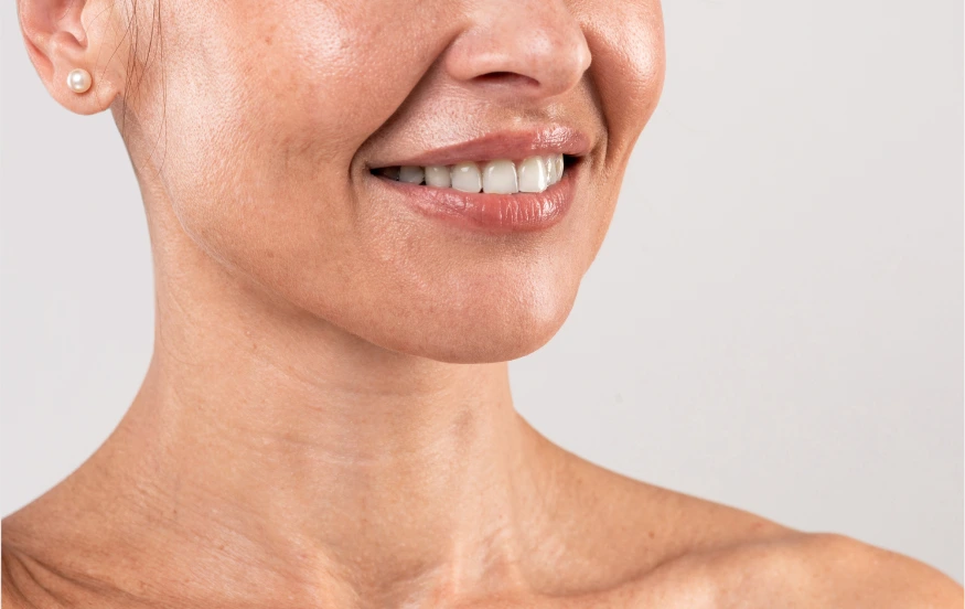 Additional Procedure Neck Lift Surgery